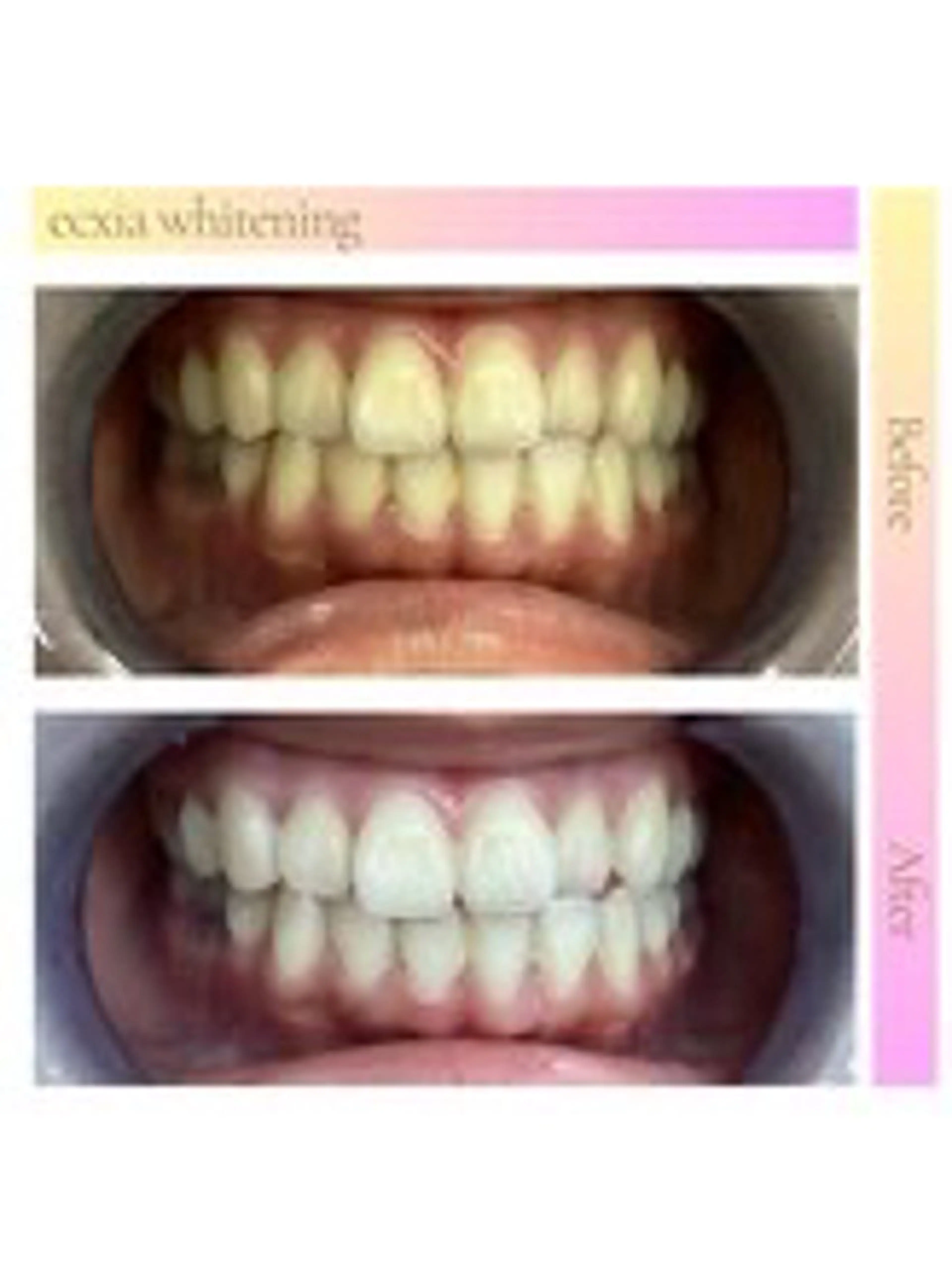 ecxia white 高田馬場所属・セルフホワイトニング エクシア 高田馬場のその他イメージ