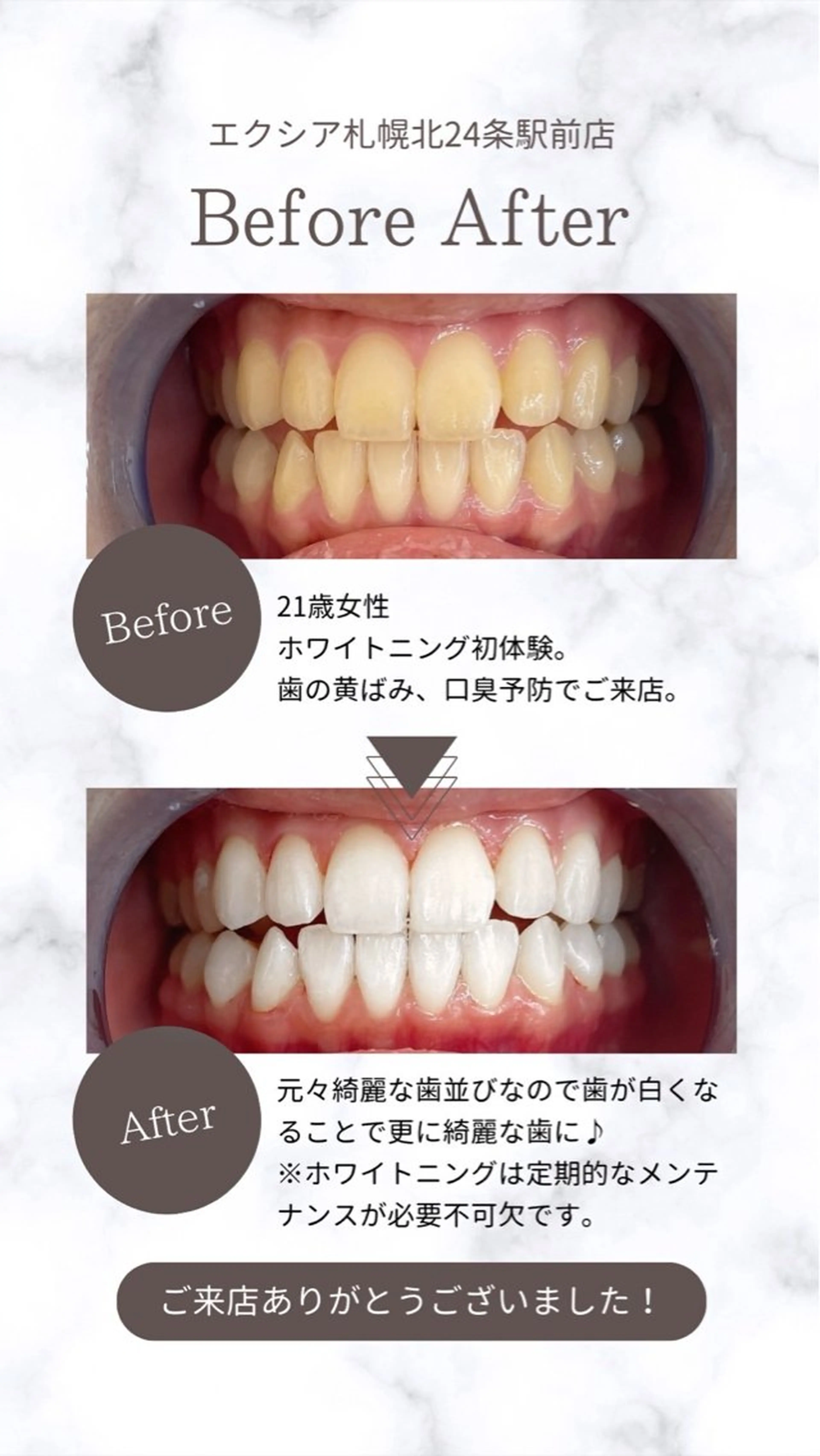 その他 エクシアホワイトニング平岸店所属・𝒀𝑼𝑰 店長⋆𝜗𝜚のその他イメージ