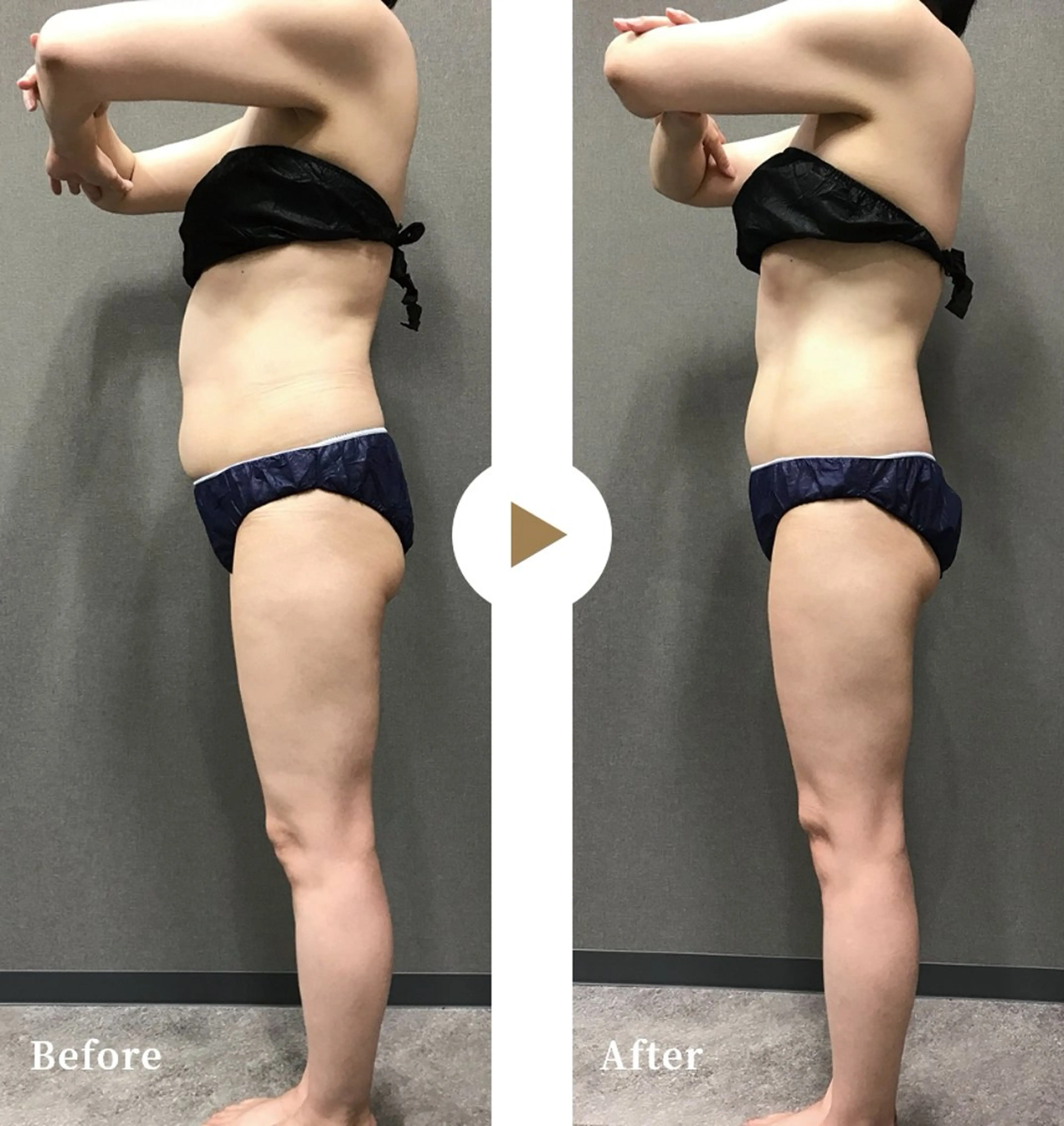 Beauty Salon Dahlia所属・福田 茜のエステ・リラクイメージ