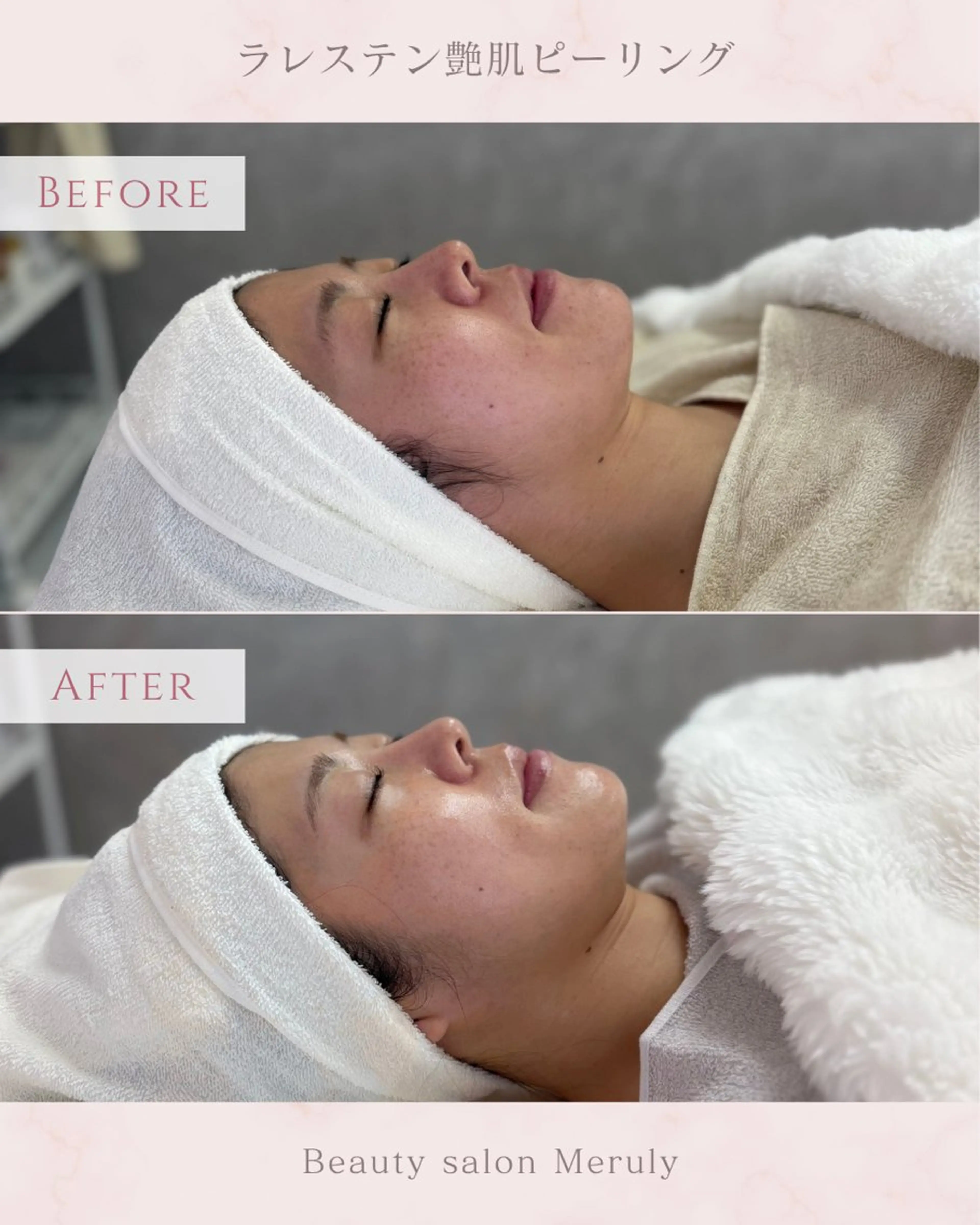 エステ Meruly所属・Meruly ♡のエステ・リラクイメージ