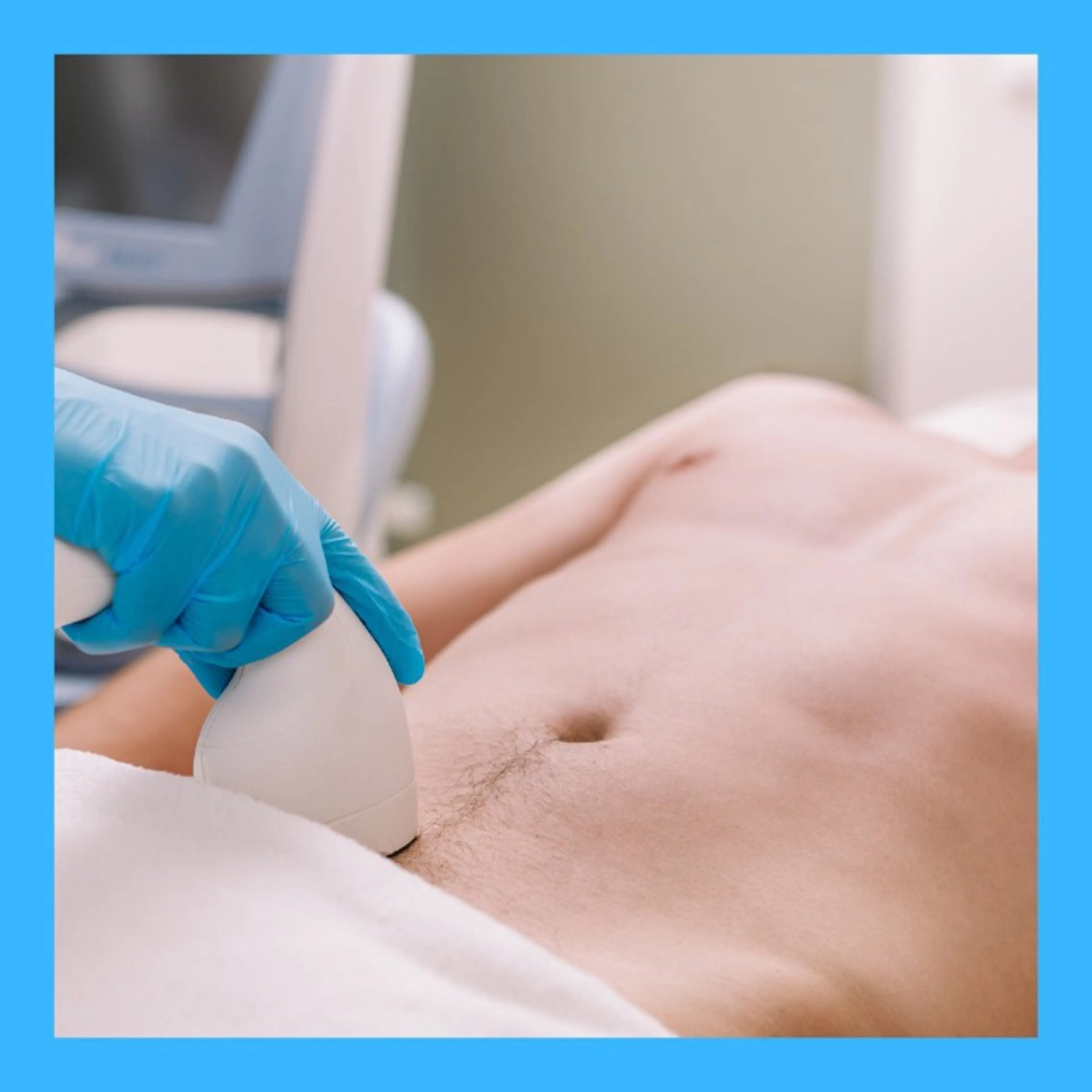 【男性限定】　VIO脱毛の写真