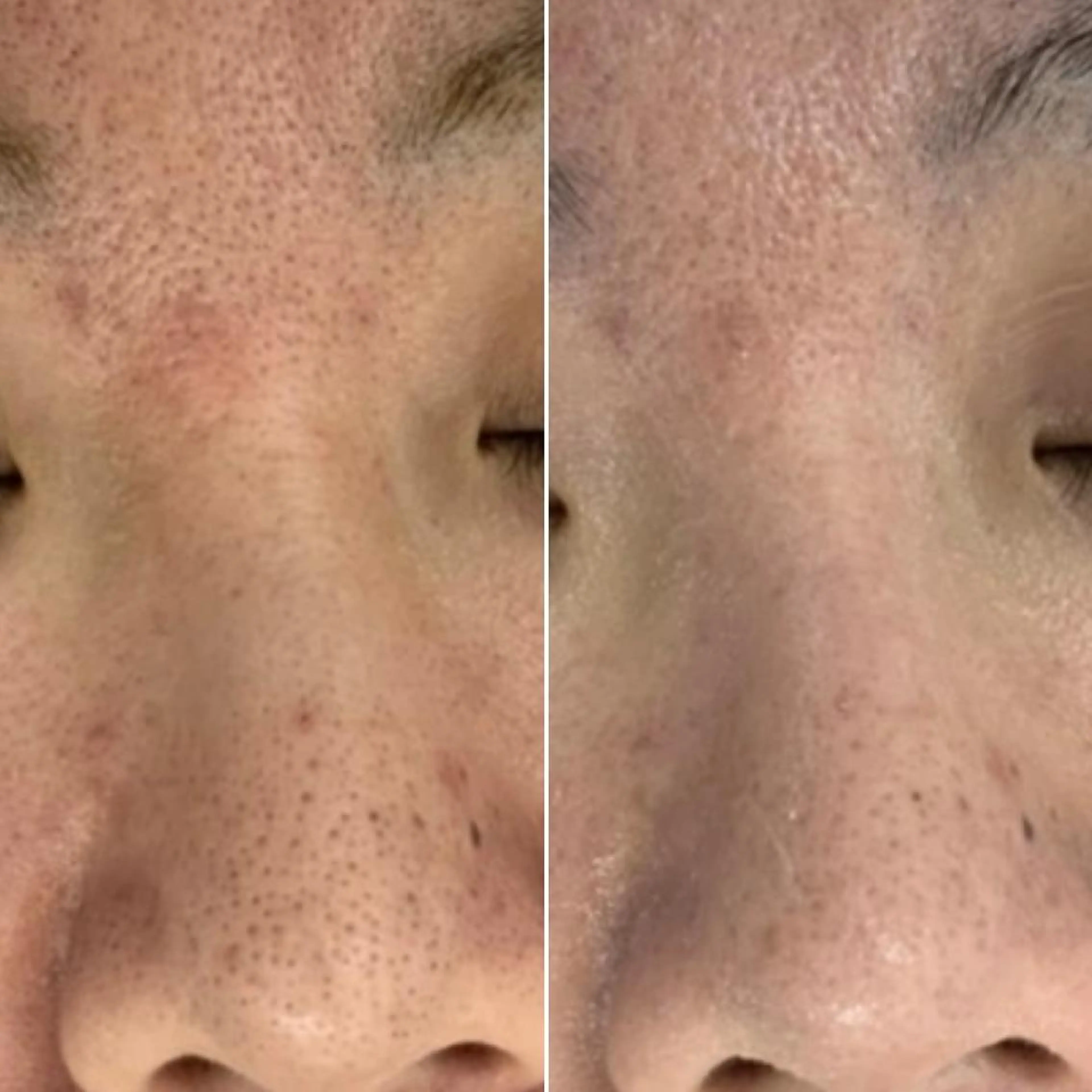 エステ リラク Nana no  Moeのエステ・リラクイメージ