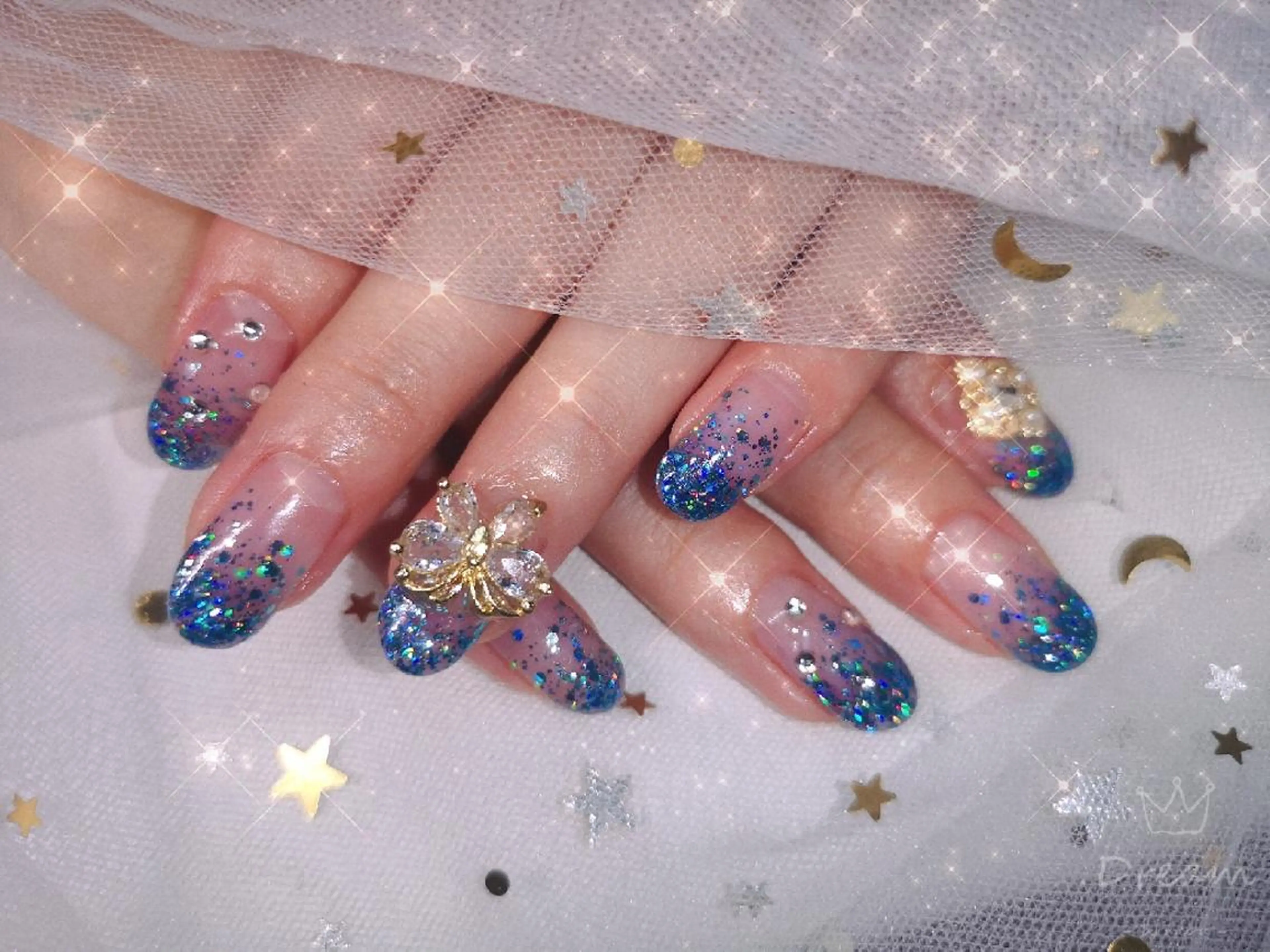 ミディアム ネイル ハンドネイル ネイリストゆか💅 長さだし、深爪矯正のネイルデザイン