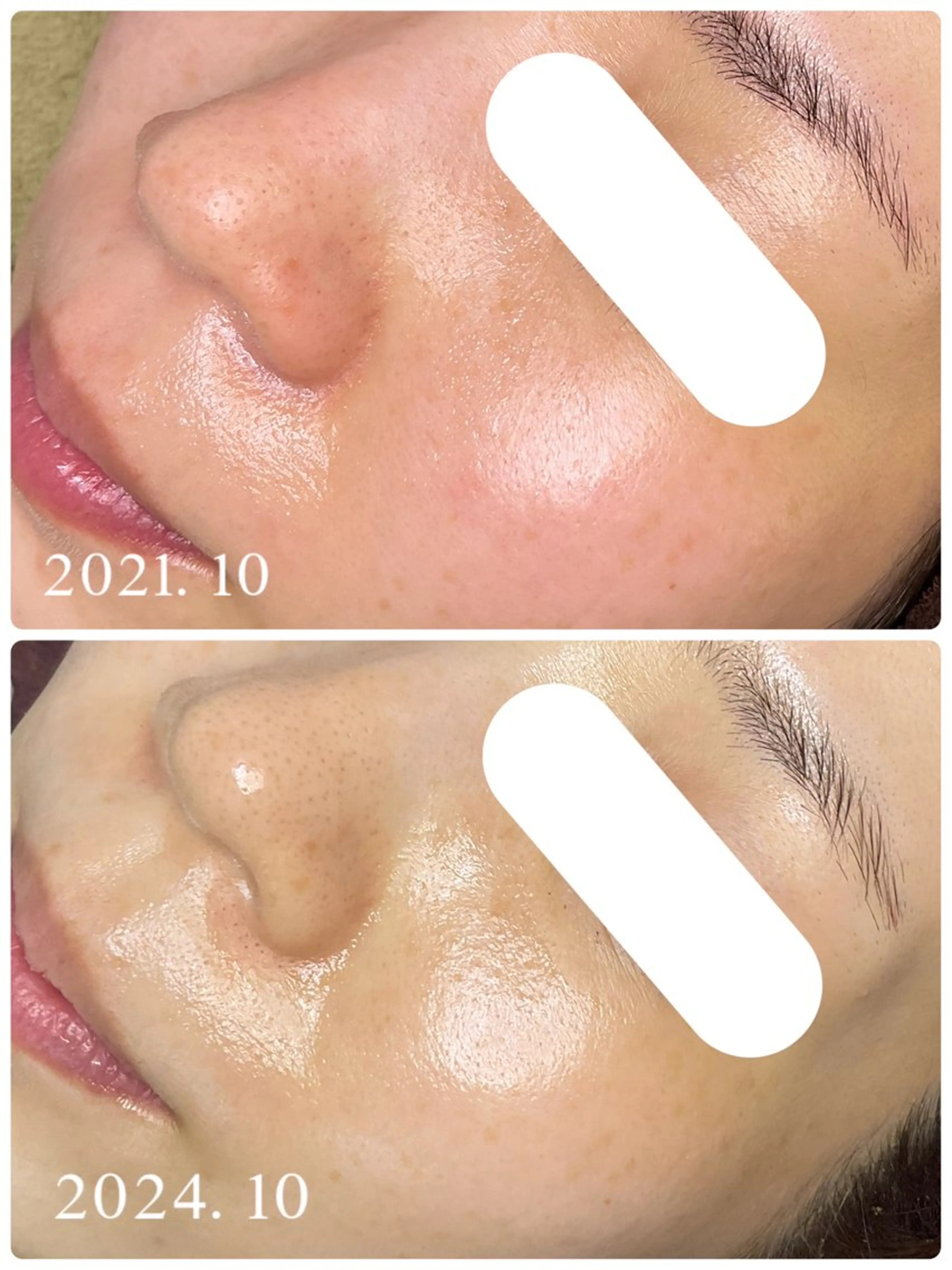 【🌿人気No.1陶肌トリートメント🌿】陶肌パウダー1g、酵素パウダーorシルクパウダー1gどちらかプレゼント🎁✨の写真