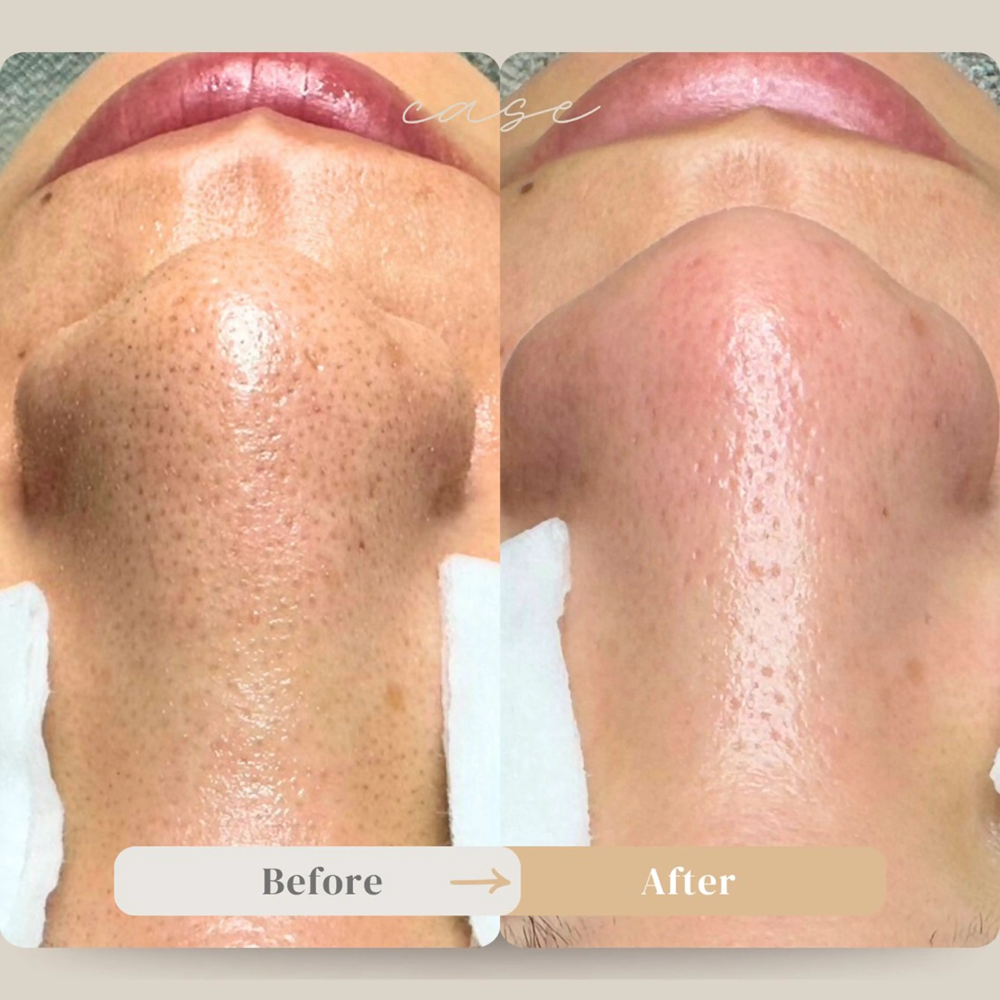 エステ 毛穴ケア特化専門店 トネア自由が丘店のエステ・リラクイメージ