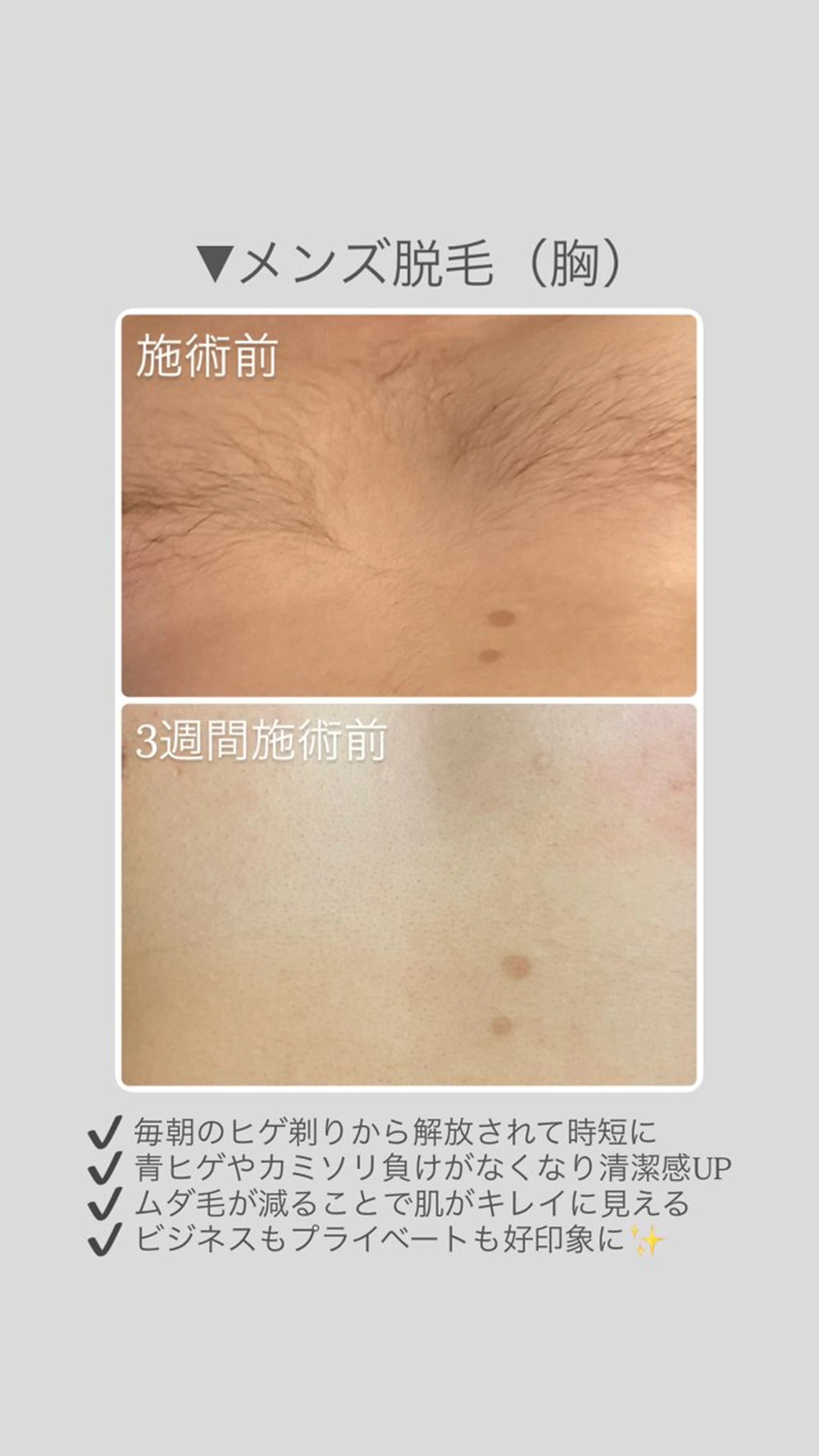 脱毛 春日井/脱毛・エステサロン　salon de AZURE所属・salon de AZUREのエステ・リラクイメージ