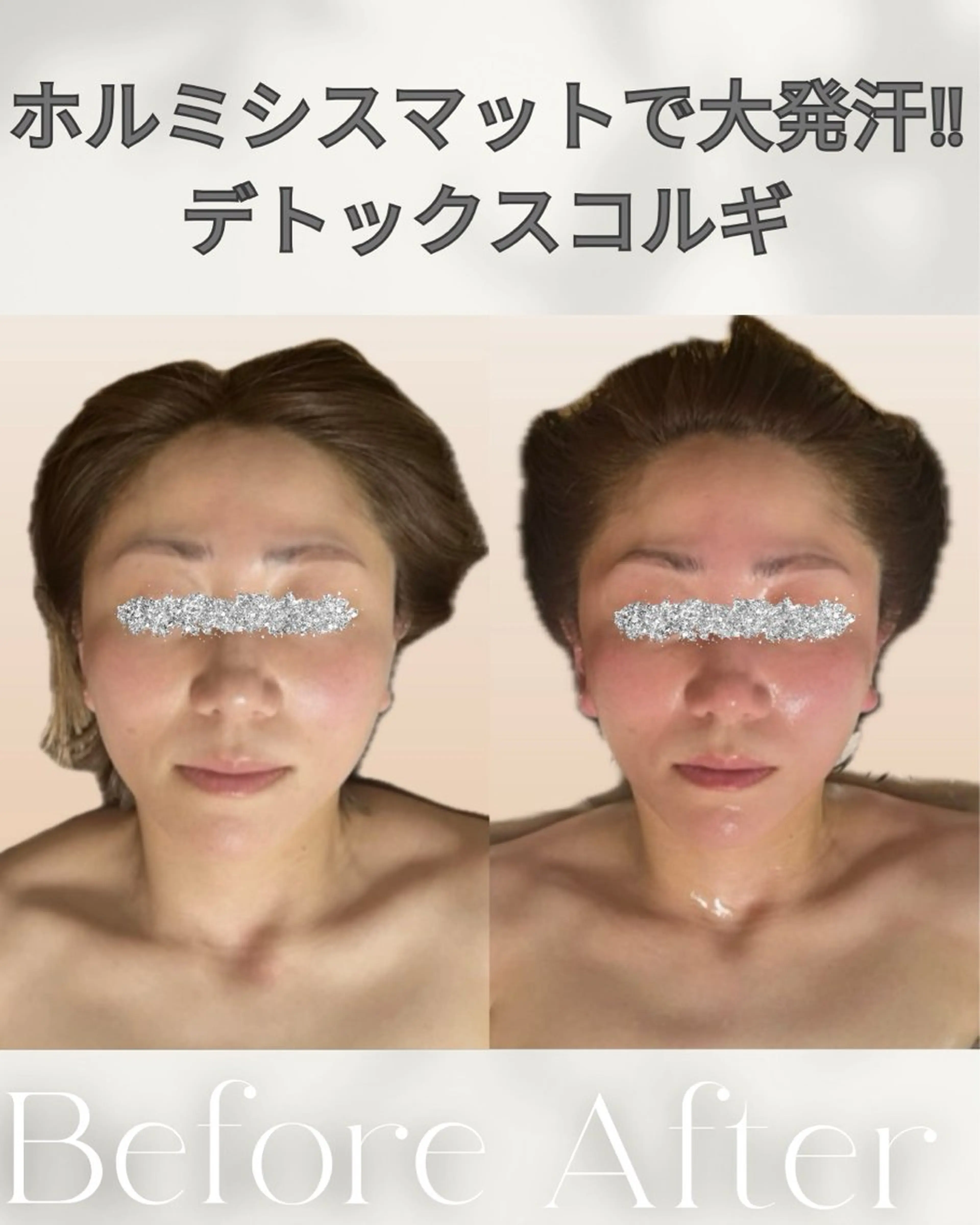 【Open記念価格】小顔コルギ✨小顔定着石膏パック&デコルテ肩首背中リンパ付き✨の写真