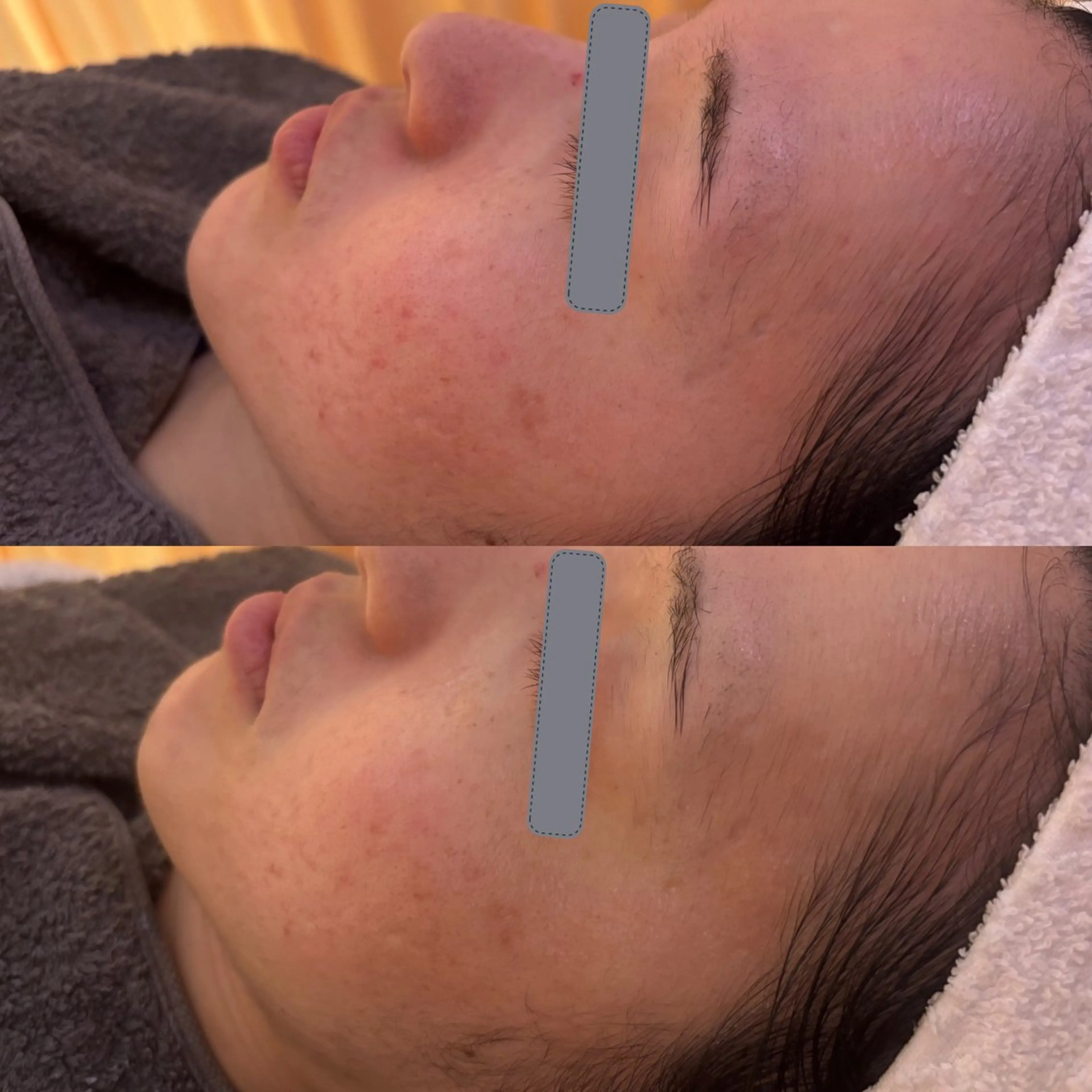 エステ リラク デアイム東広島所属・中井 小春のエステ・リラクイメージ