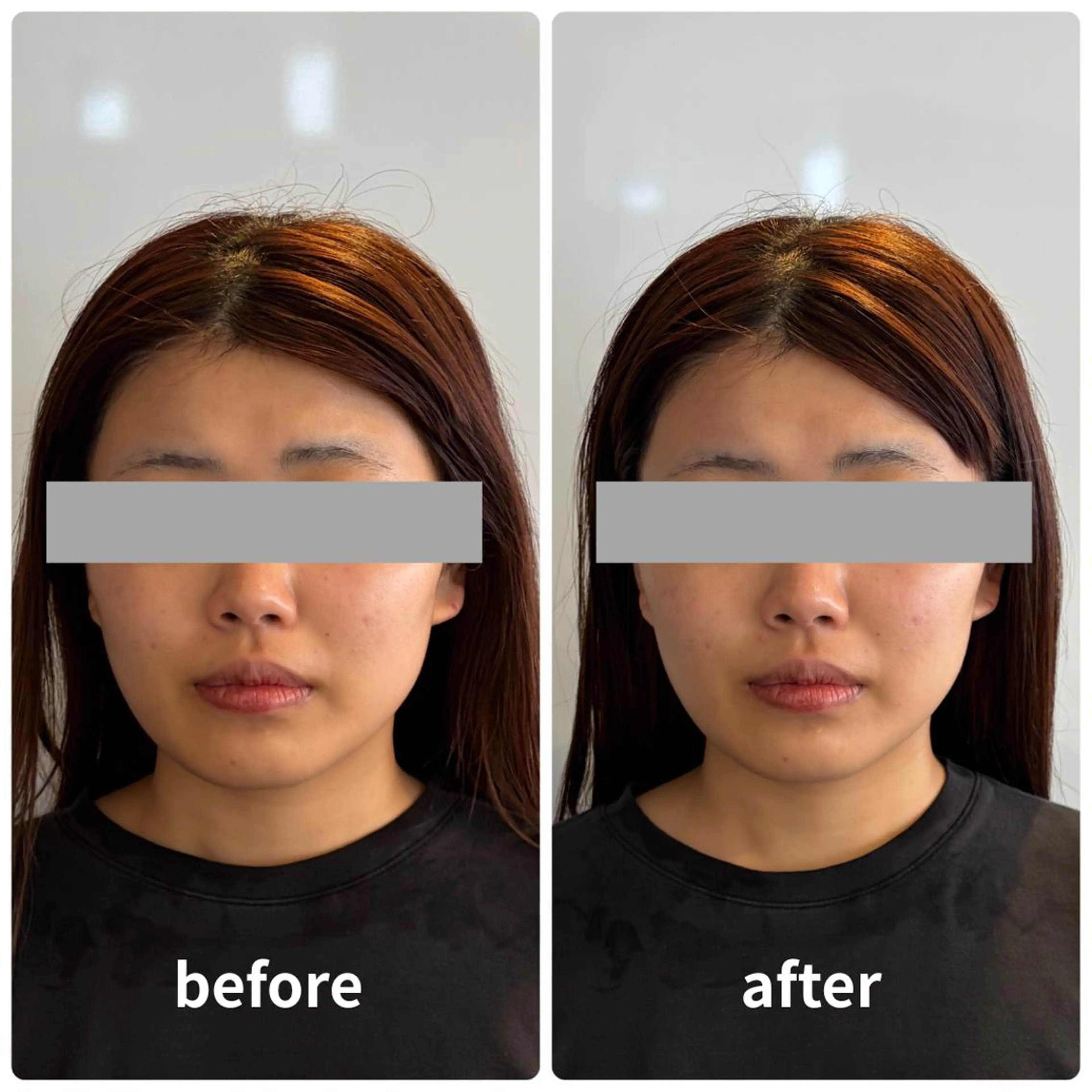 小顔矯正/整体師 丸山綾野のエステ・リラクイメージ