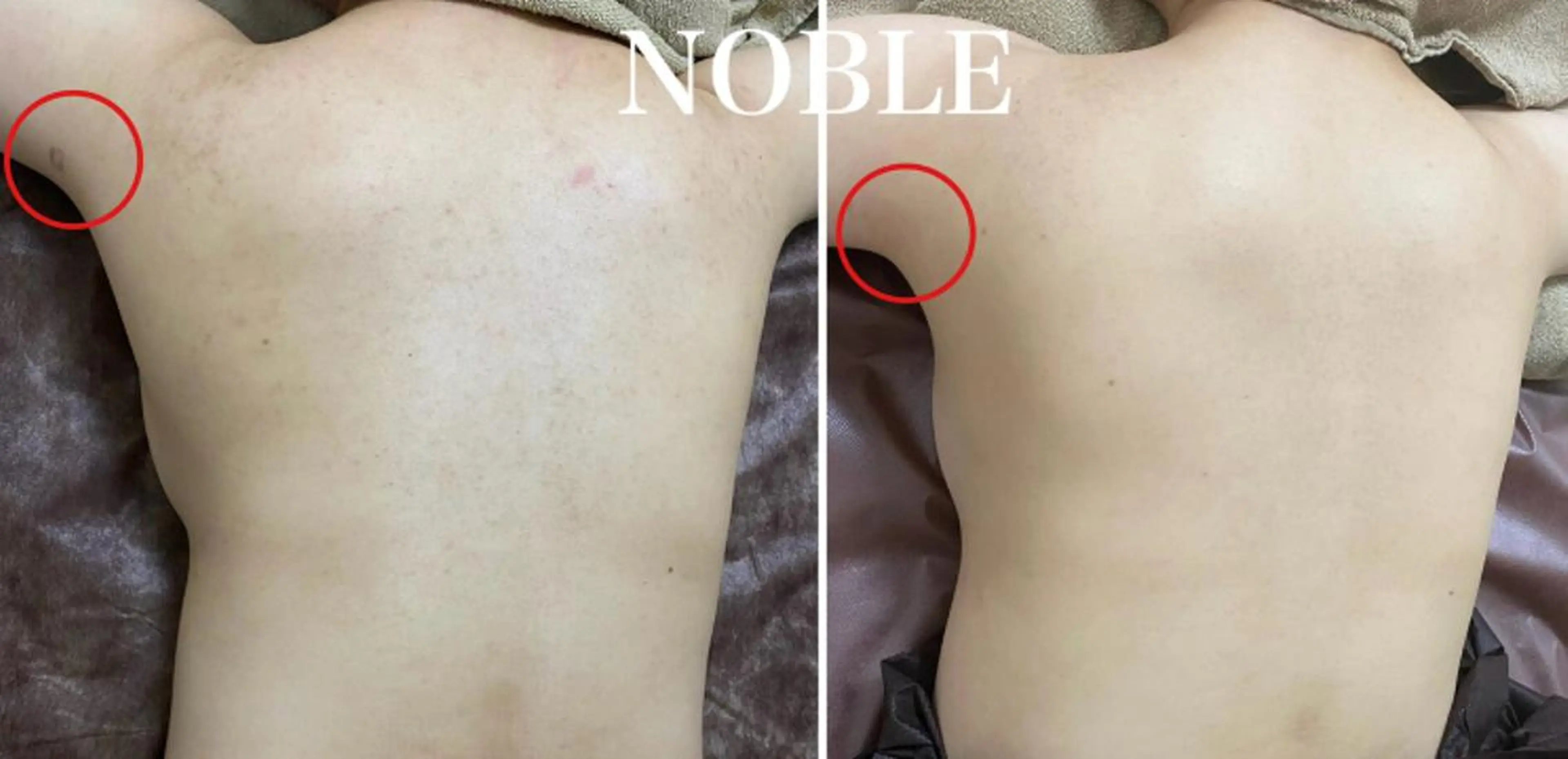 NOBLE 新宿南口店のエステ・リラクイメージ