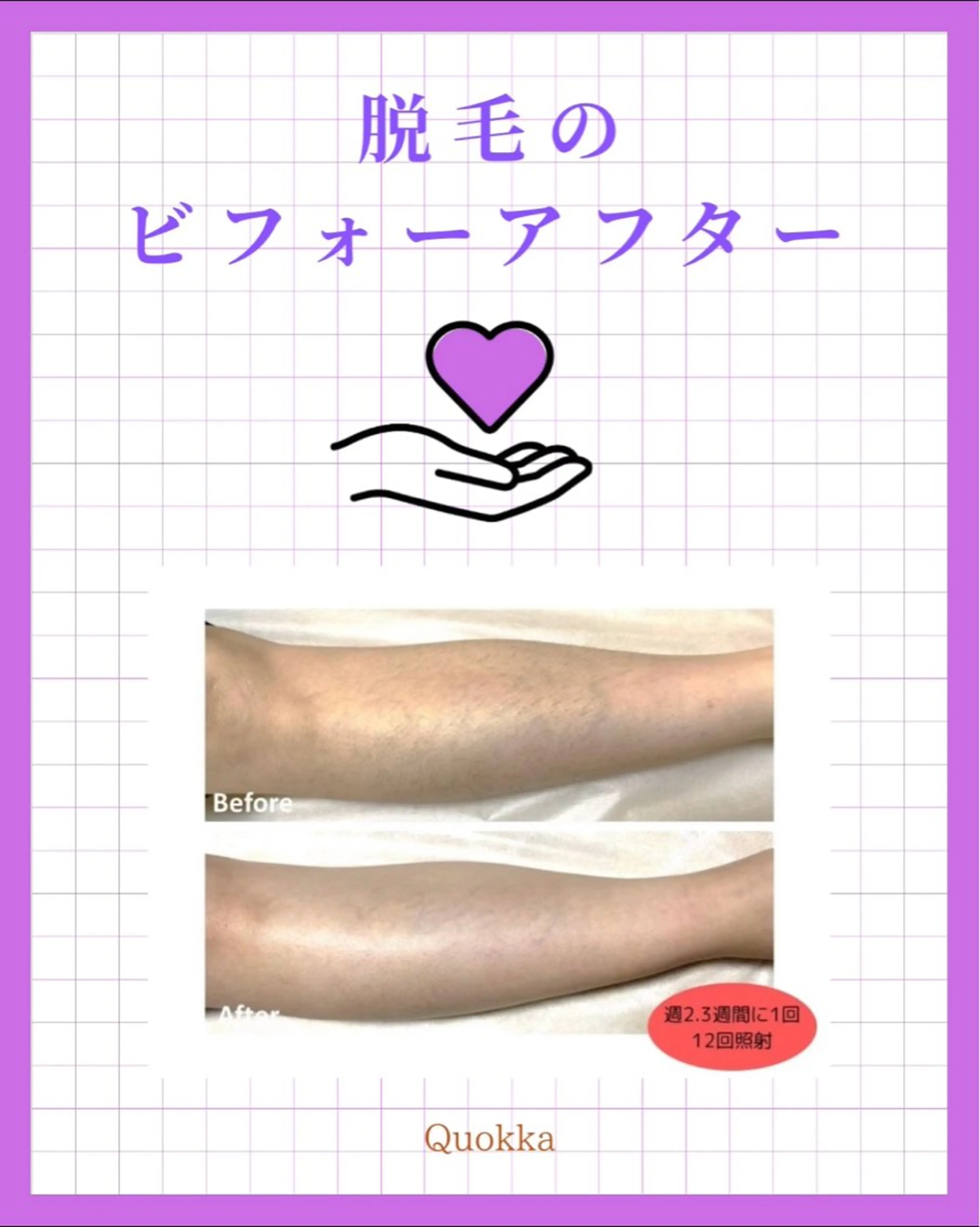 脱毛 Quokka ✴︎ あま市甚目寺のエステ・リラクイメージ