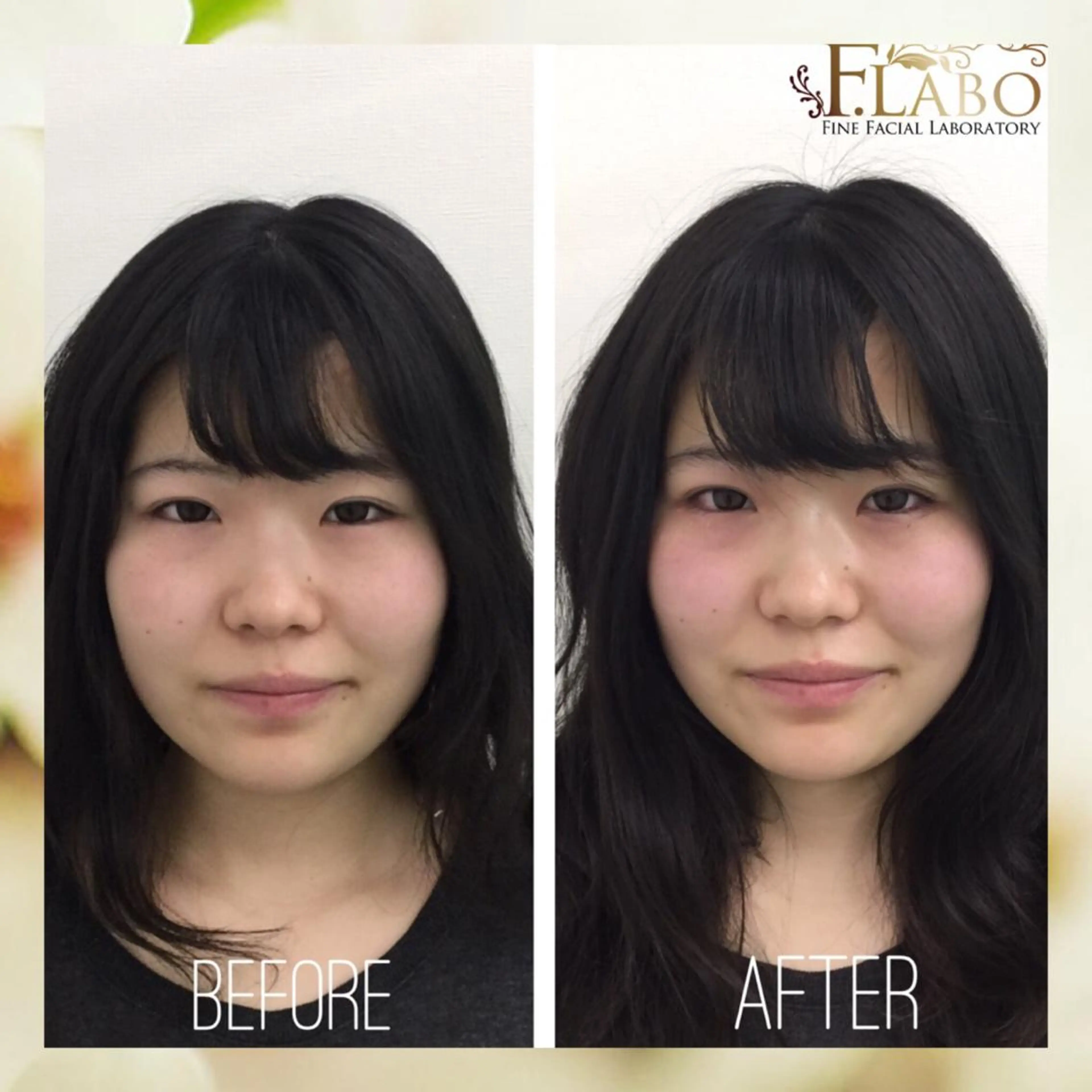 その他 小顔&ダイエットジム エステ担当REIKOのその他イメージ