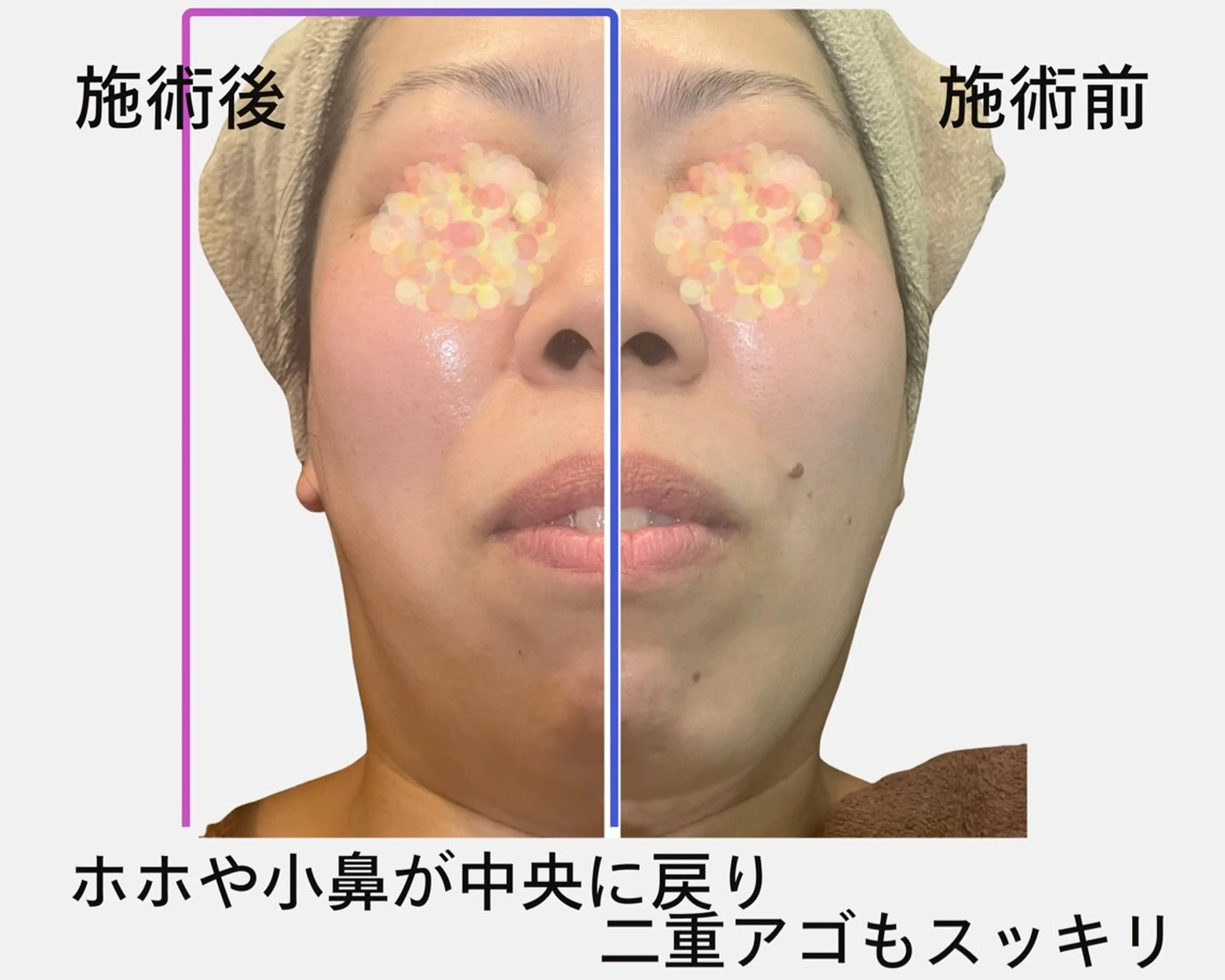 パーソナルビューティ アイリー所属・パーソナルサロン iley【アイリー】のエステ・リラクイメージ