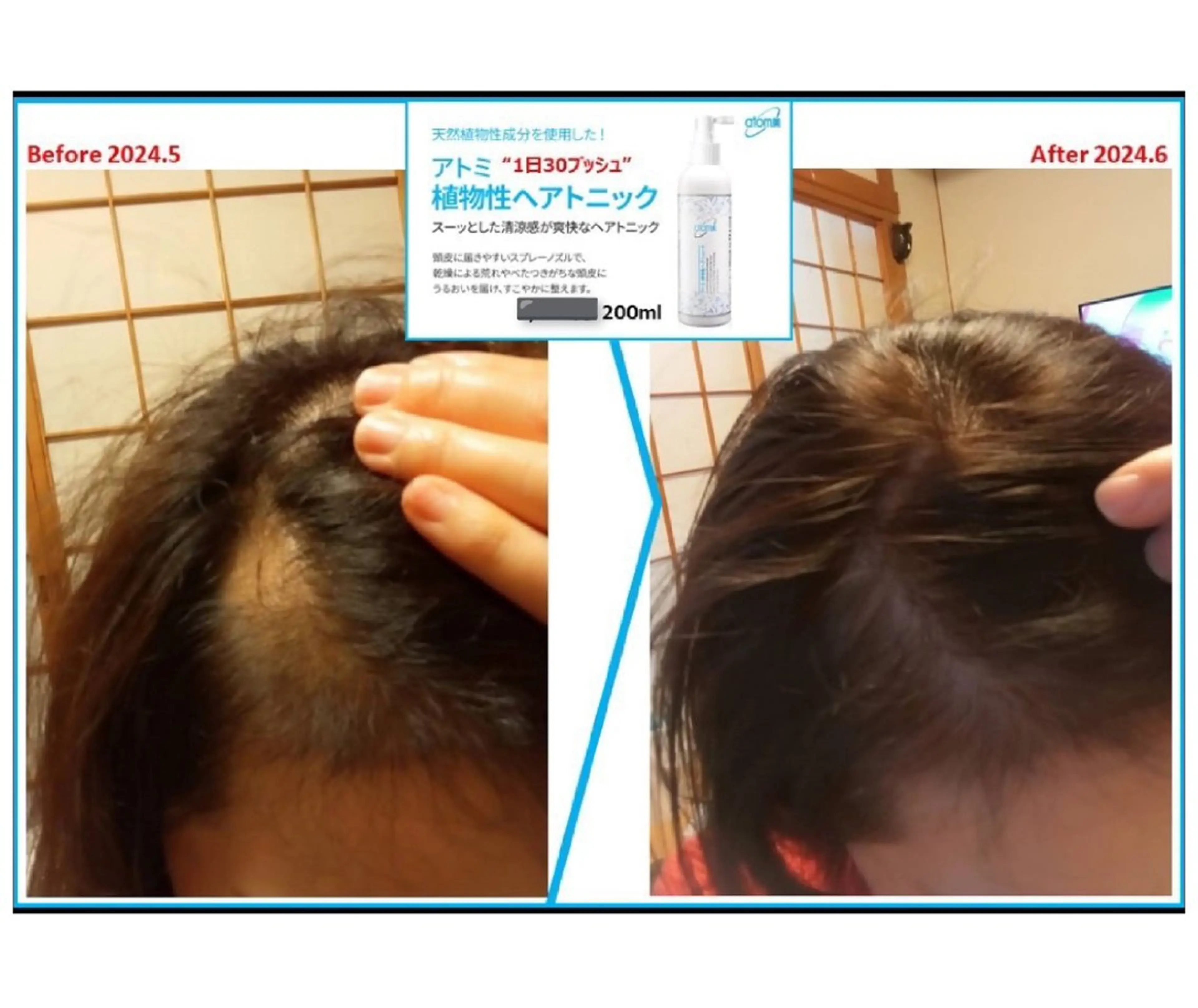 ヘッドスパ(植物性のヘアケア製品も会員で購入できます)の写真