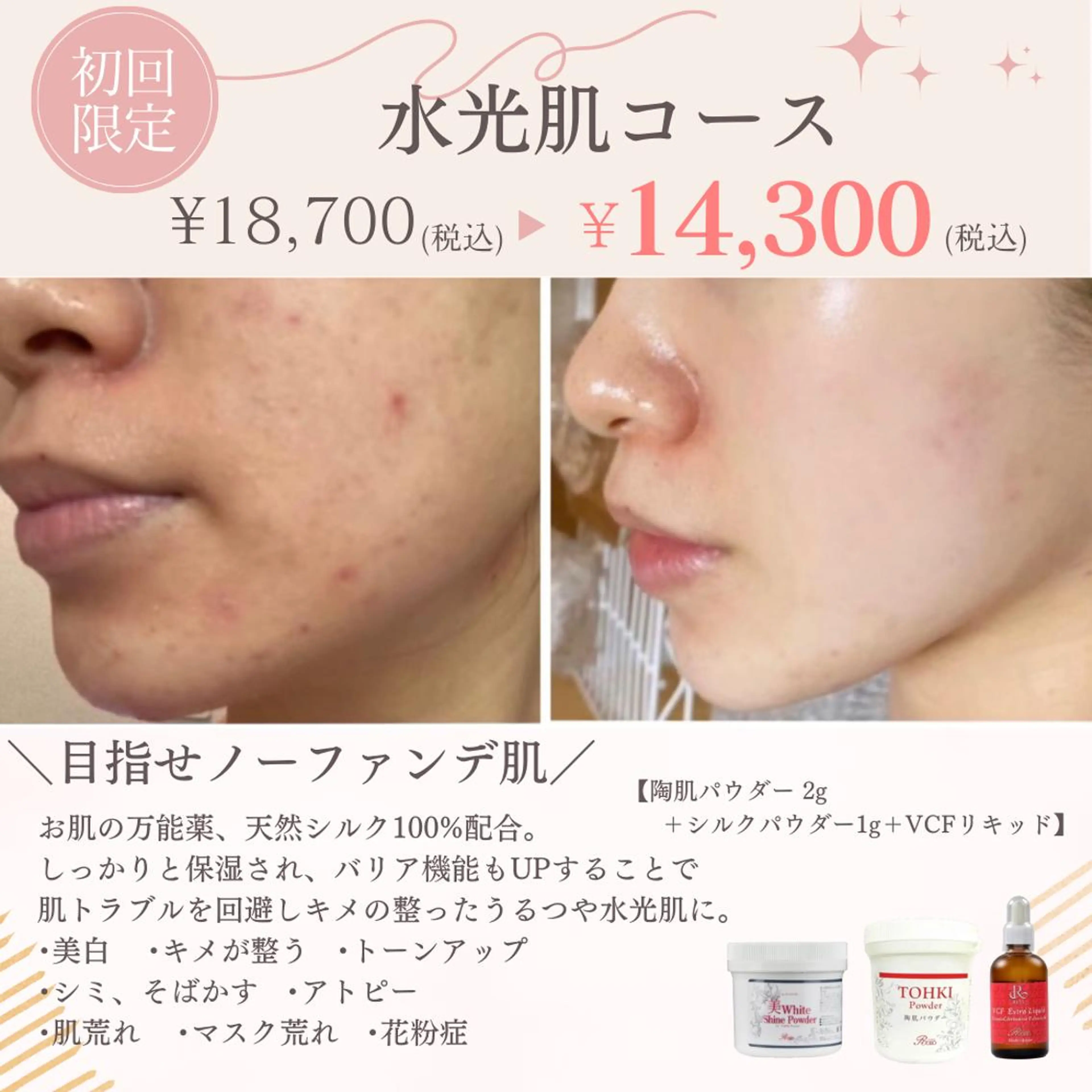 hm NATURESKINのエステ・リラクイメージ