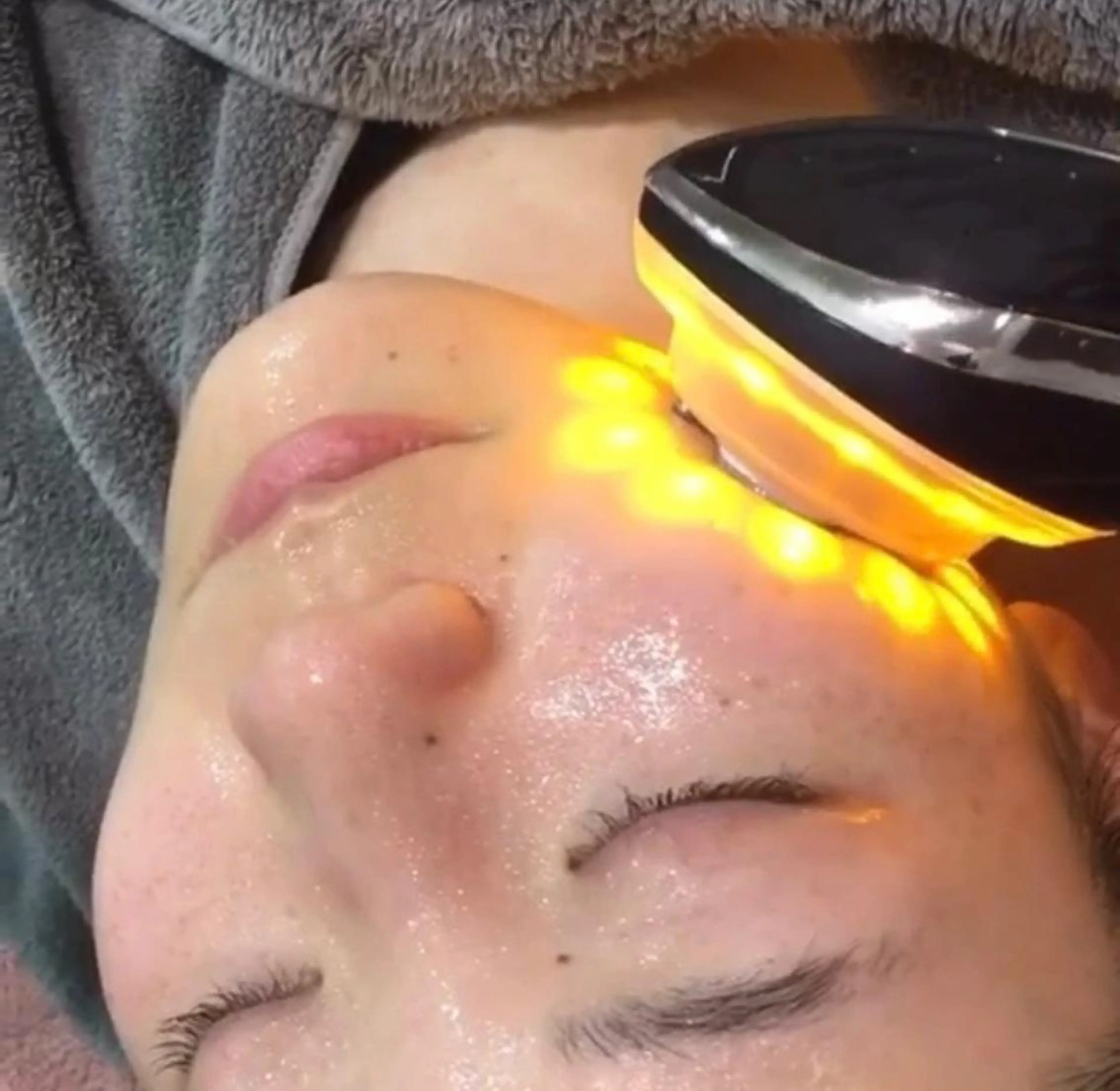 大人気☝️✨🌈美容成分導入☀️超フェイスUP美肌コースの写真