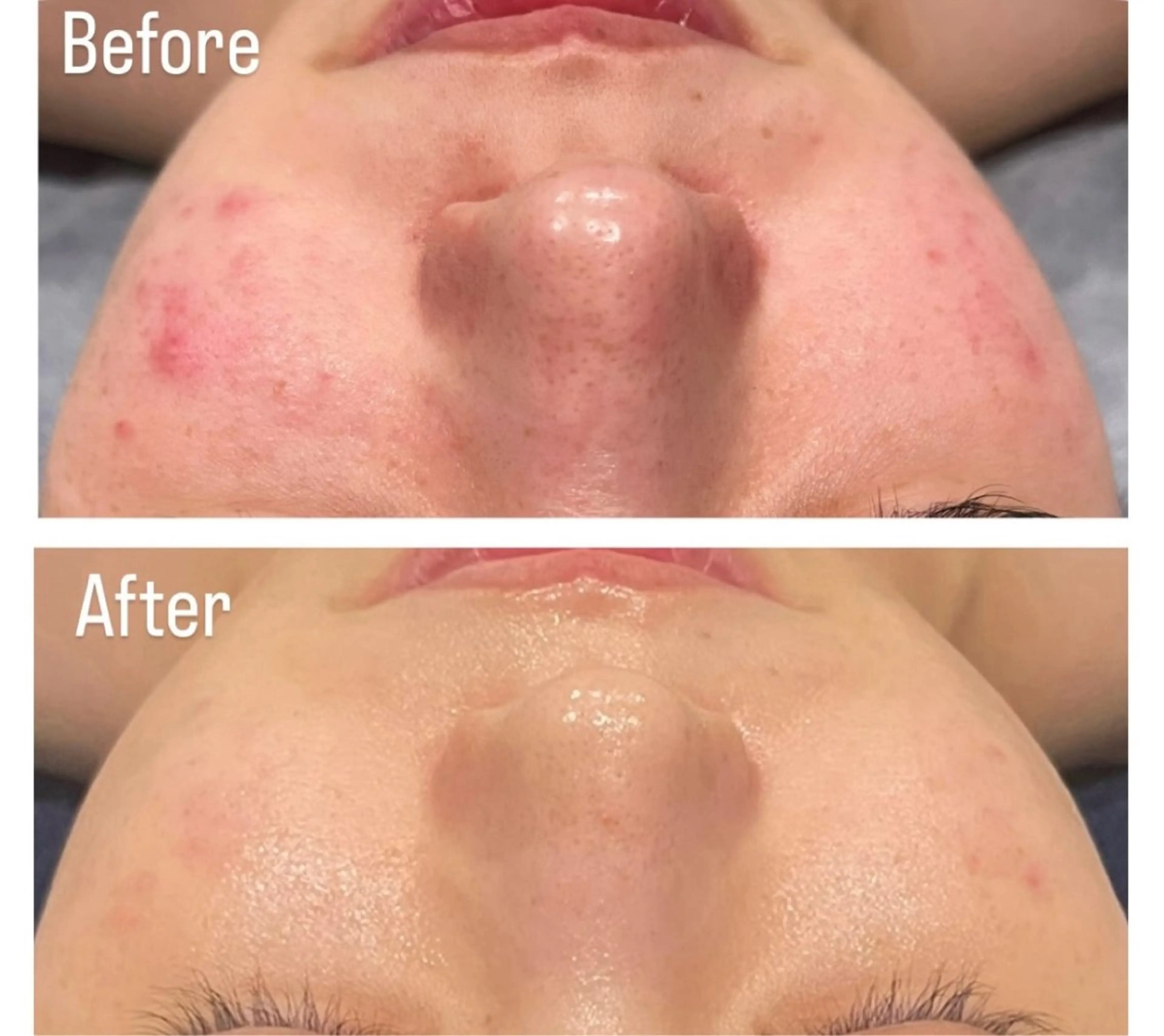 アンド ミルルのエステ・リラクイメージ