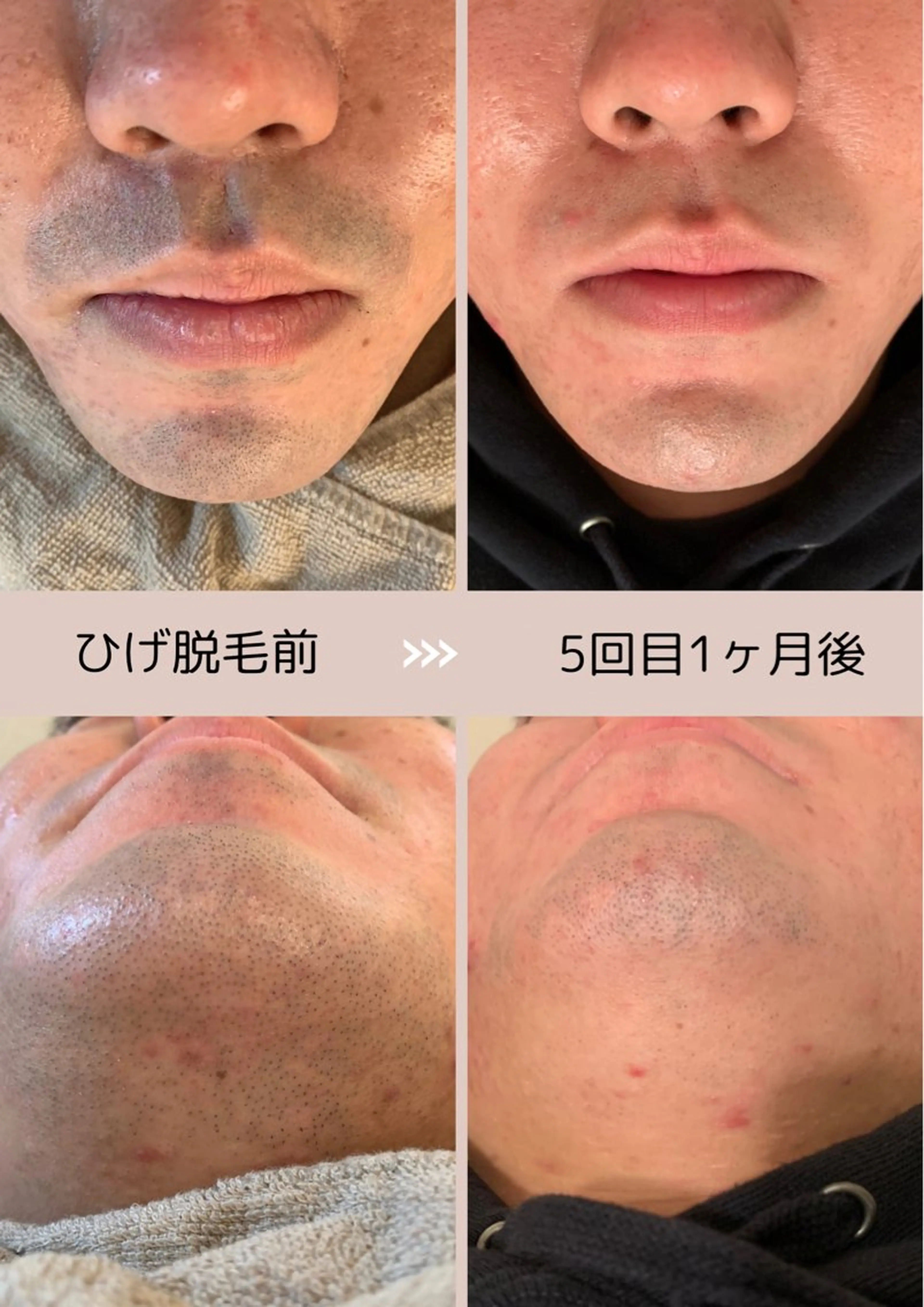 メンズ プライベート脱毛サロン　Arum所属・脱毛サロン Arumのエステ・リラクイメージ