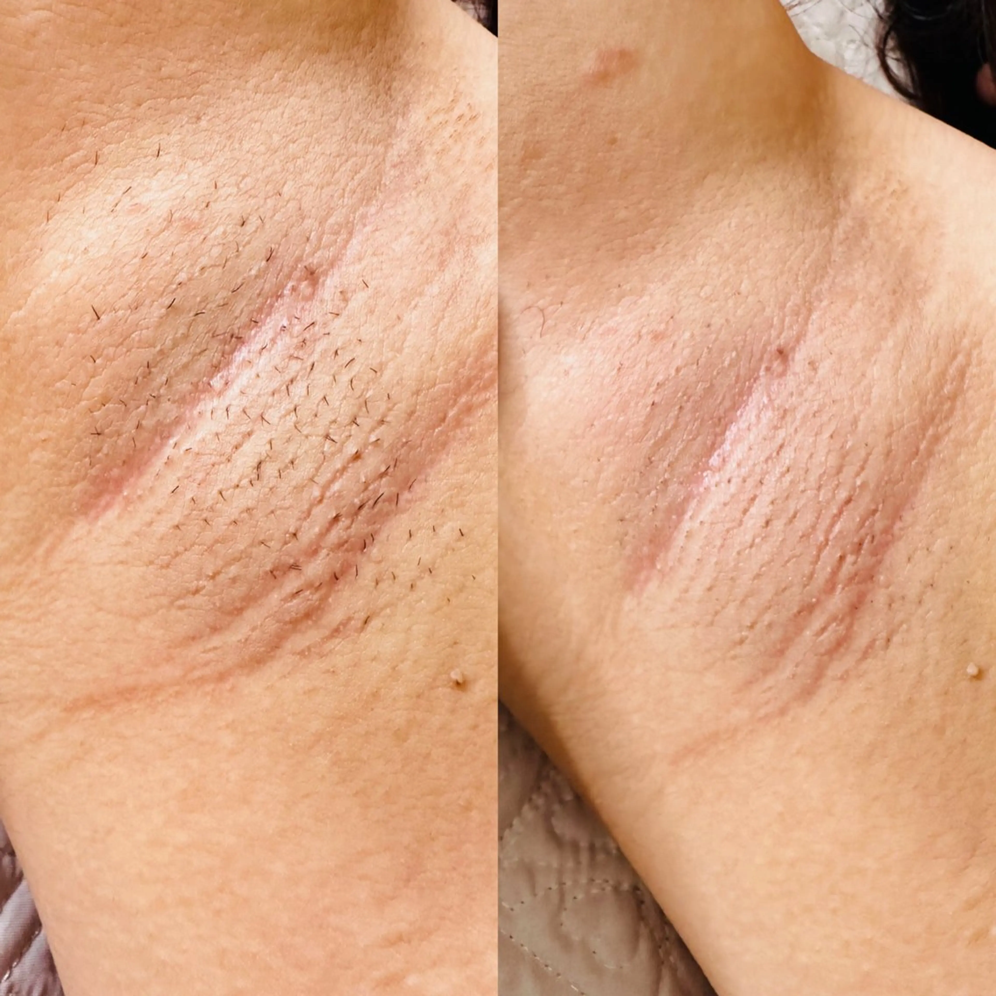 Thu Huyen Beauty所属・トウ フェンのエステ・リラクイメージ