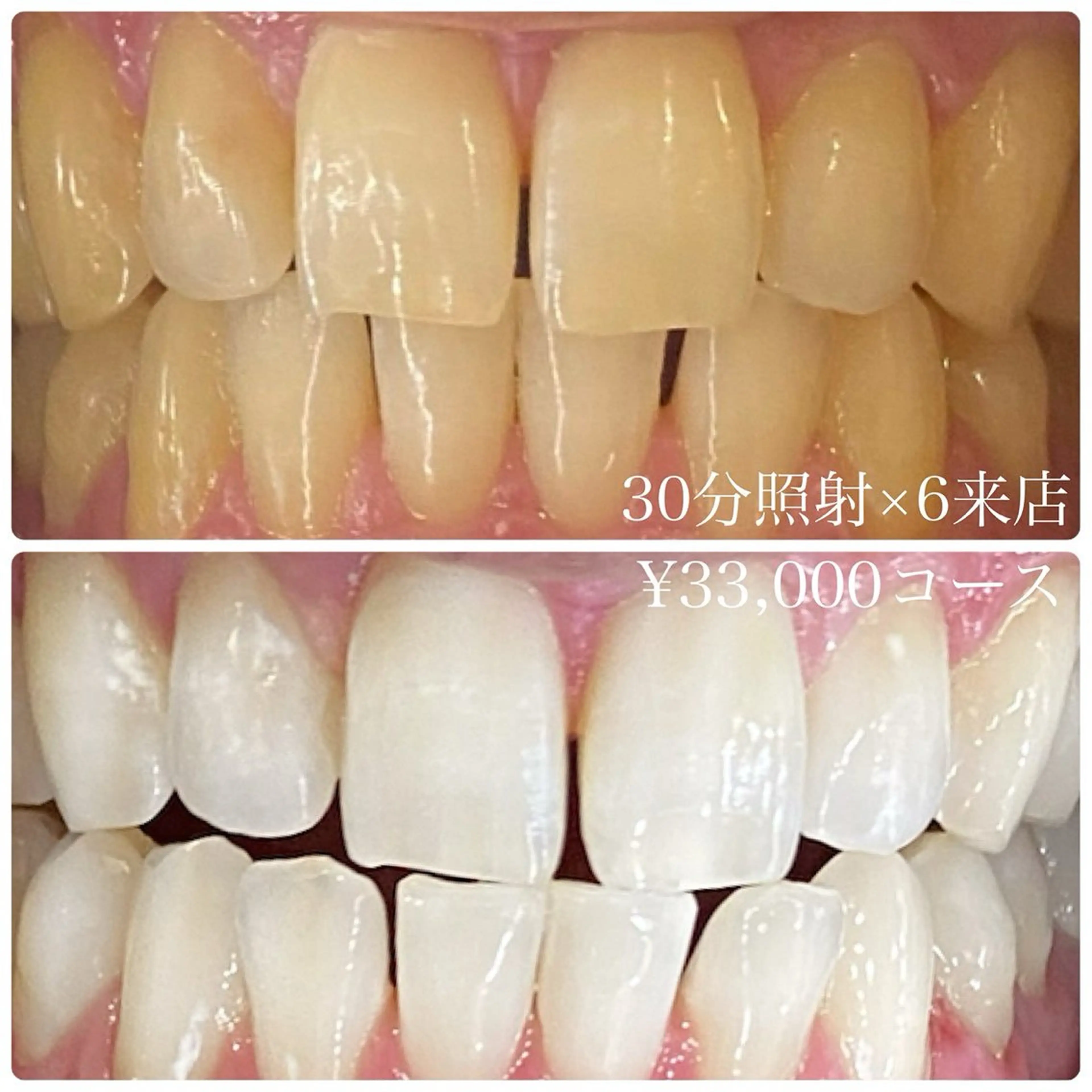 PLATINUM Beauty 横浜店所属・ホワイトニングルーム 横浜店のその他イメージ