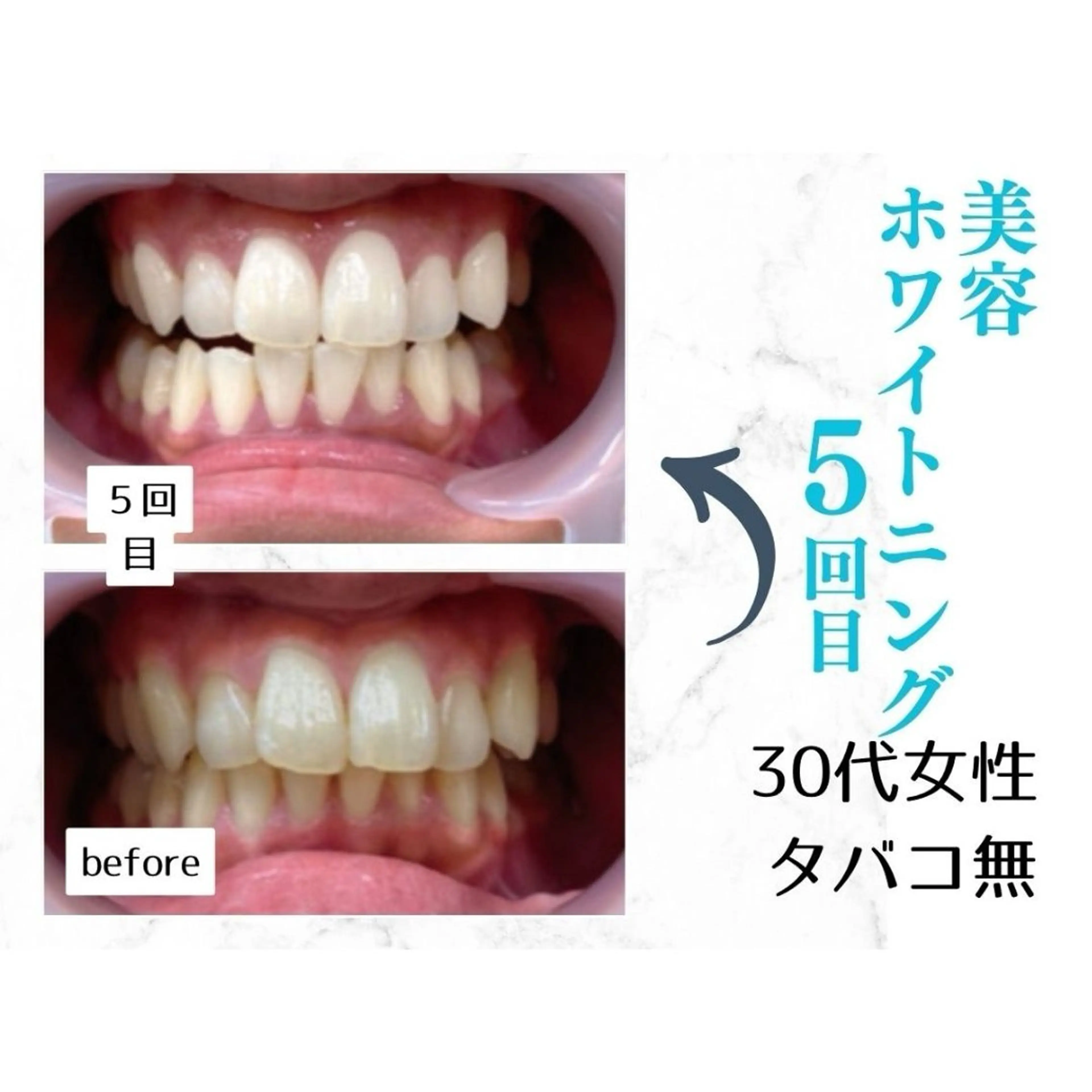 ホワイトニングサロン le  canonのその他イメージ