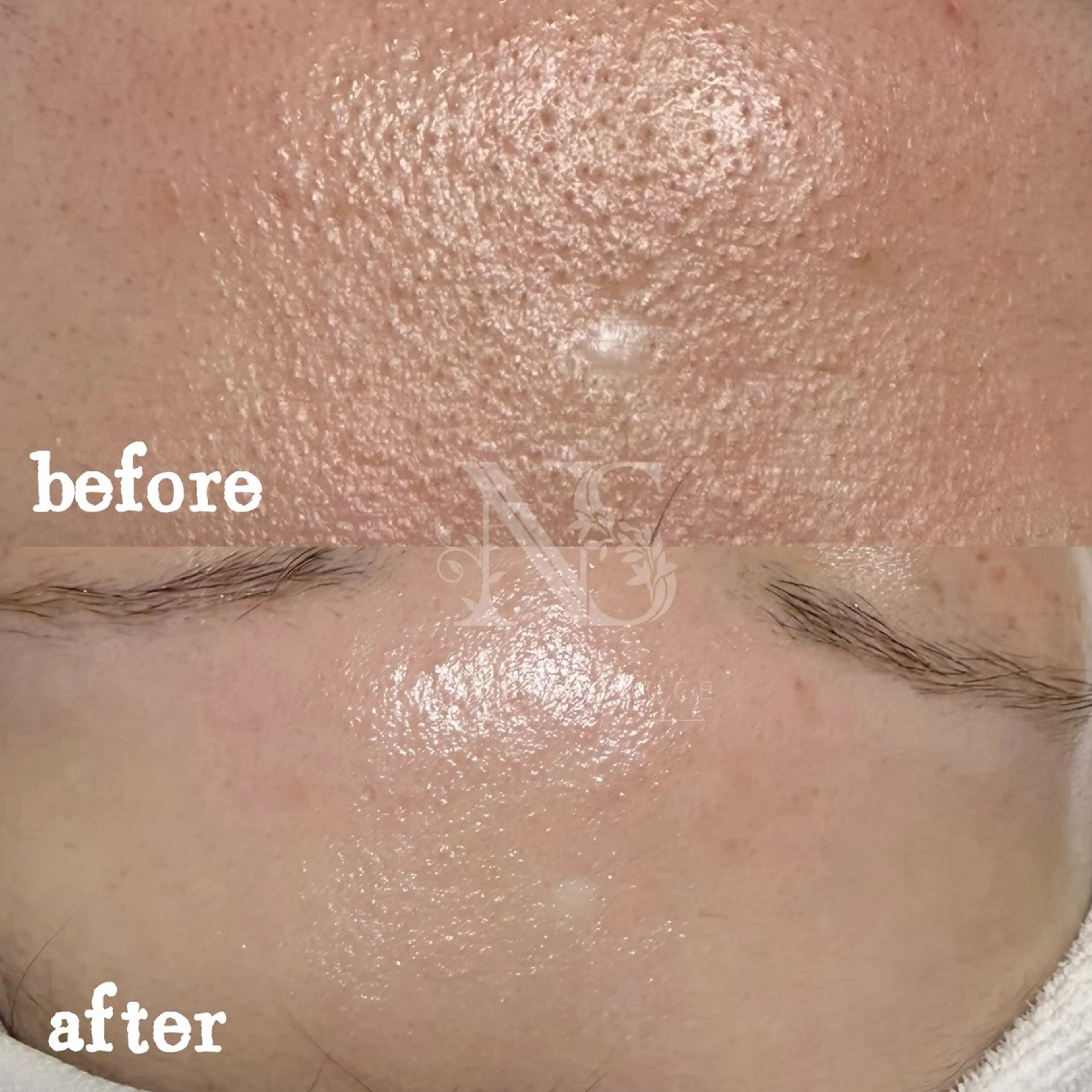 その他 Nature Souce毛穴専門店のその他イメージ