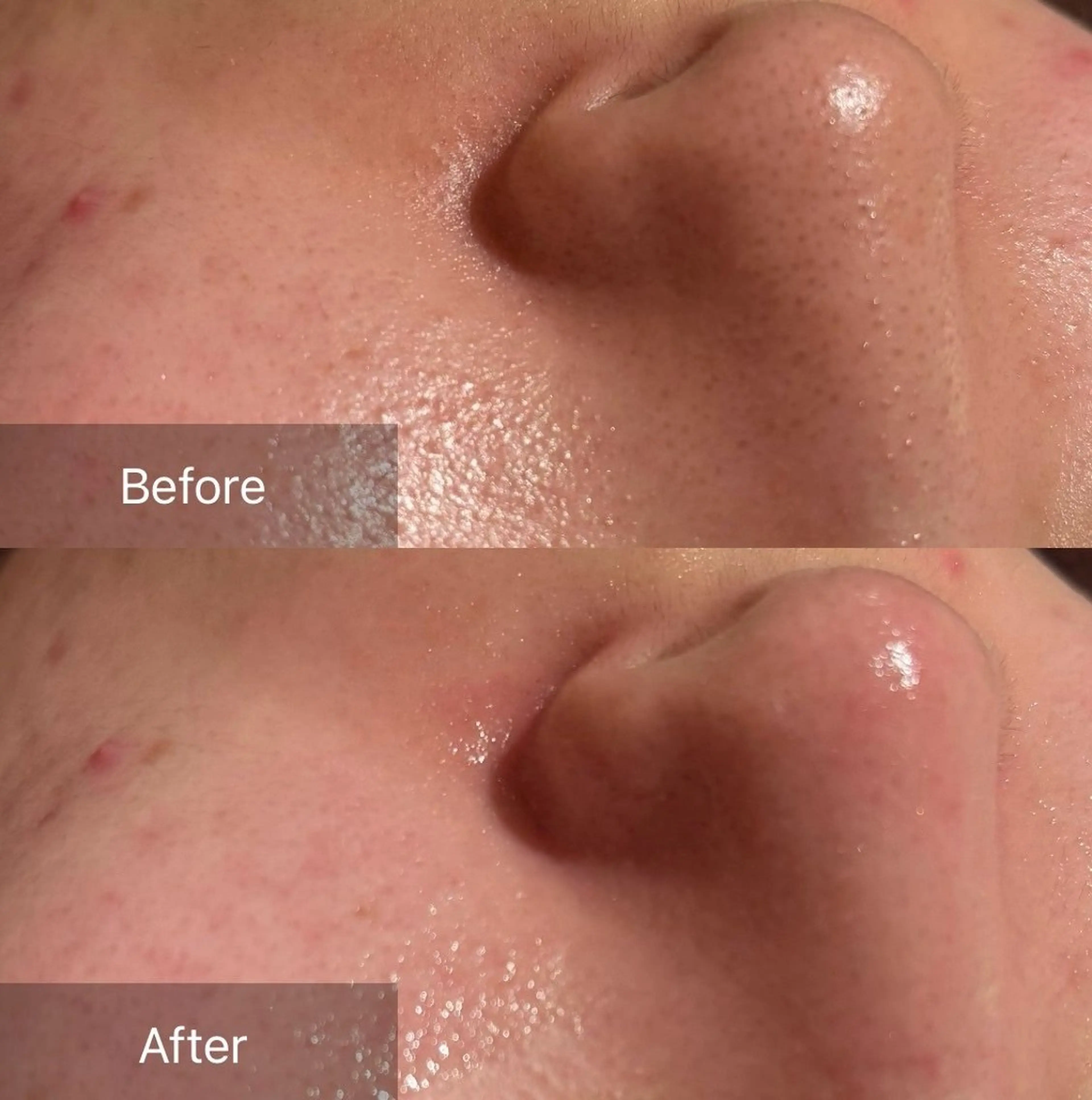 その他 for woman所属・森 美優のエステ・リラクイメージ