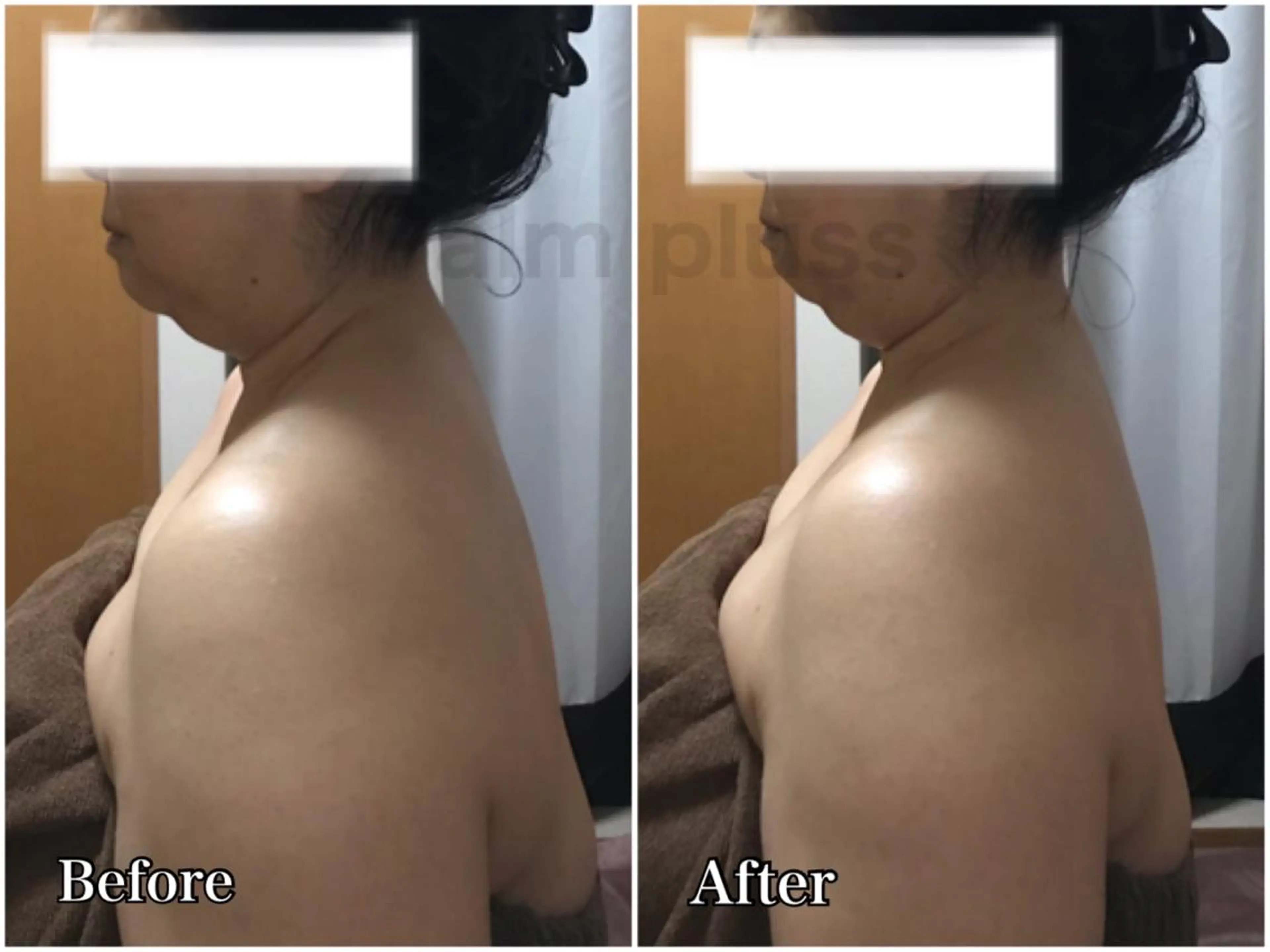 『ガチガチ肩こり＋疲労の蓄積がある方に』全身調整リンパ90分コースの写真