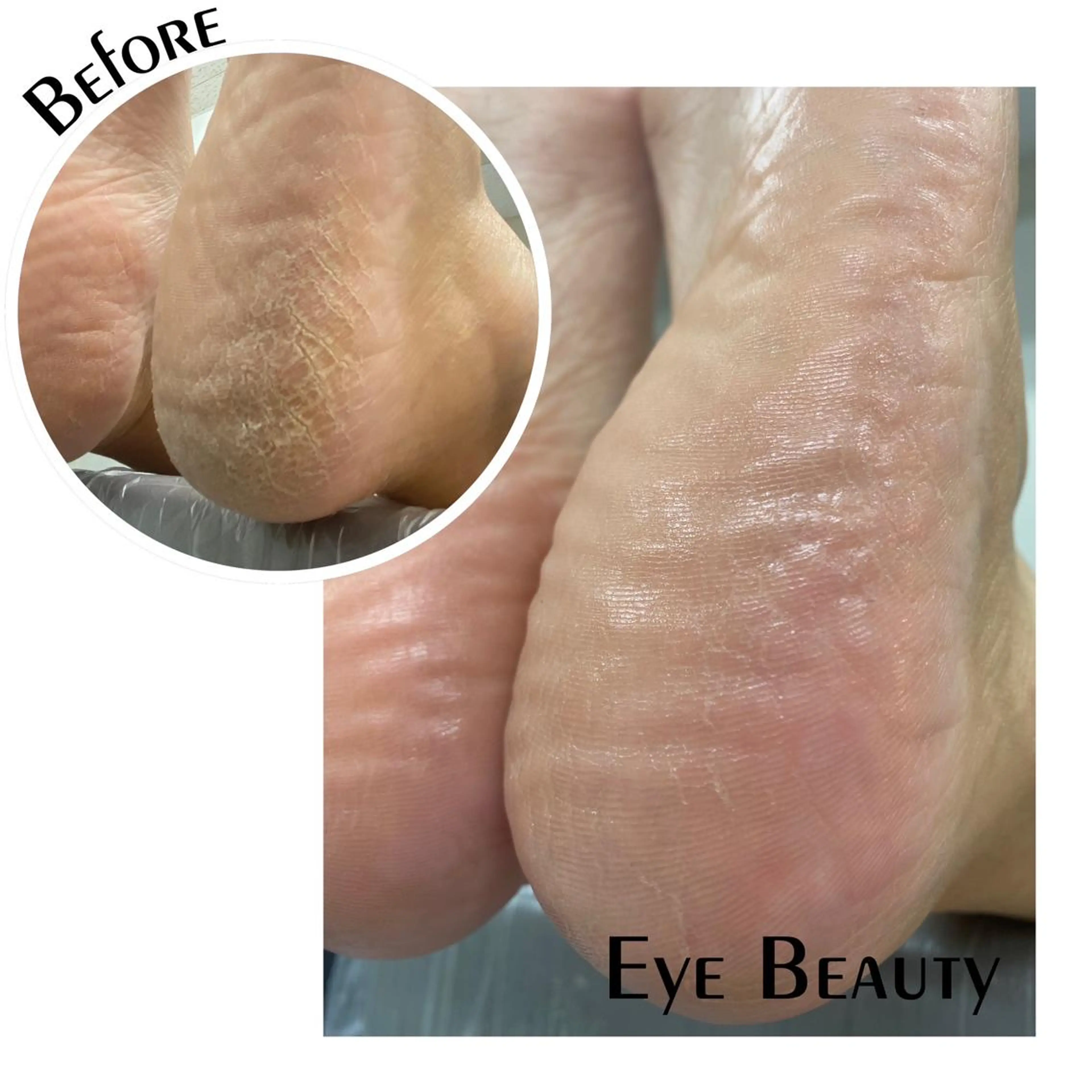 その他 Eye   Beauty所属・松田 由紀のマツエク・マツパデザイン