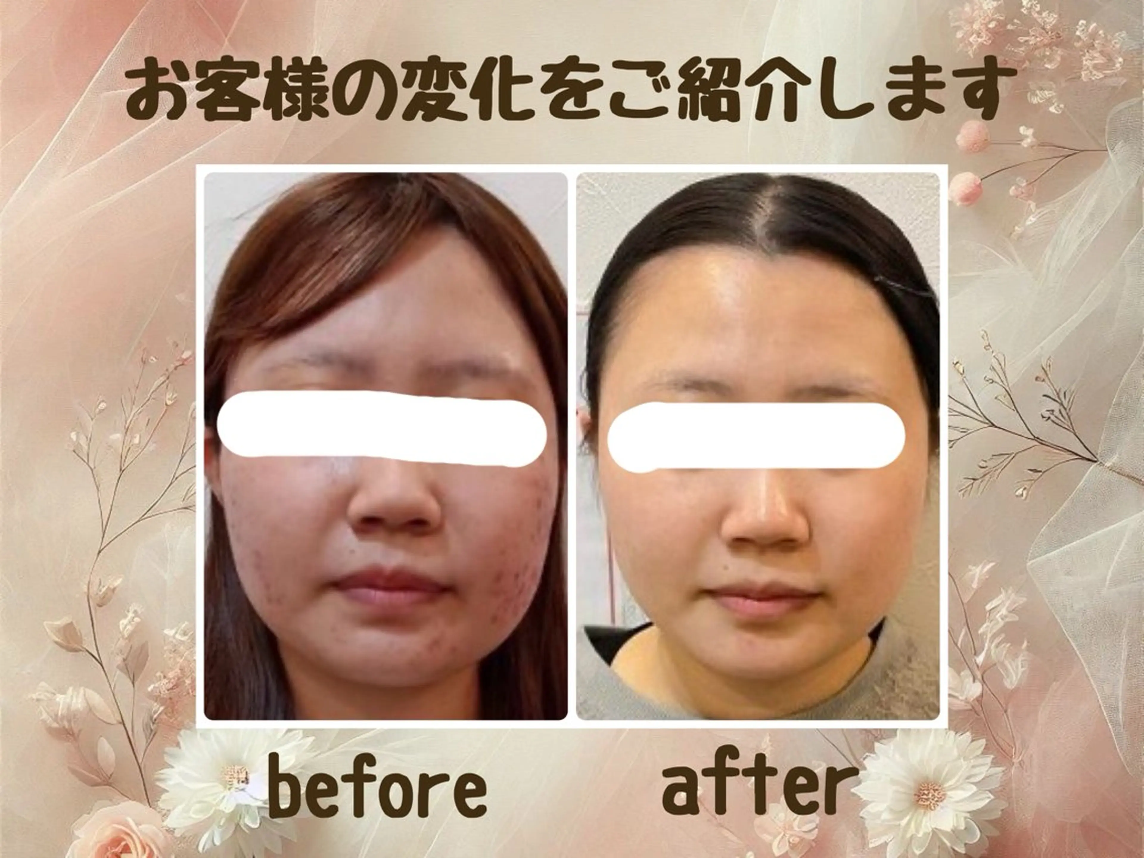 エステ 小顔矯正＆美肌サロン ブプラ大元駅前店のエステ・リラクイメージ