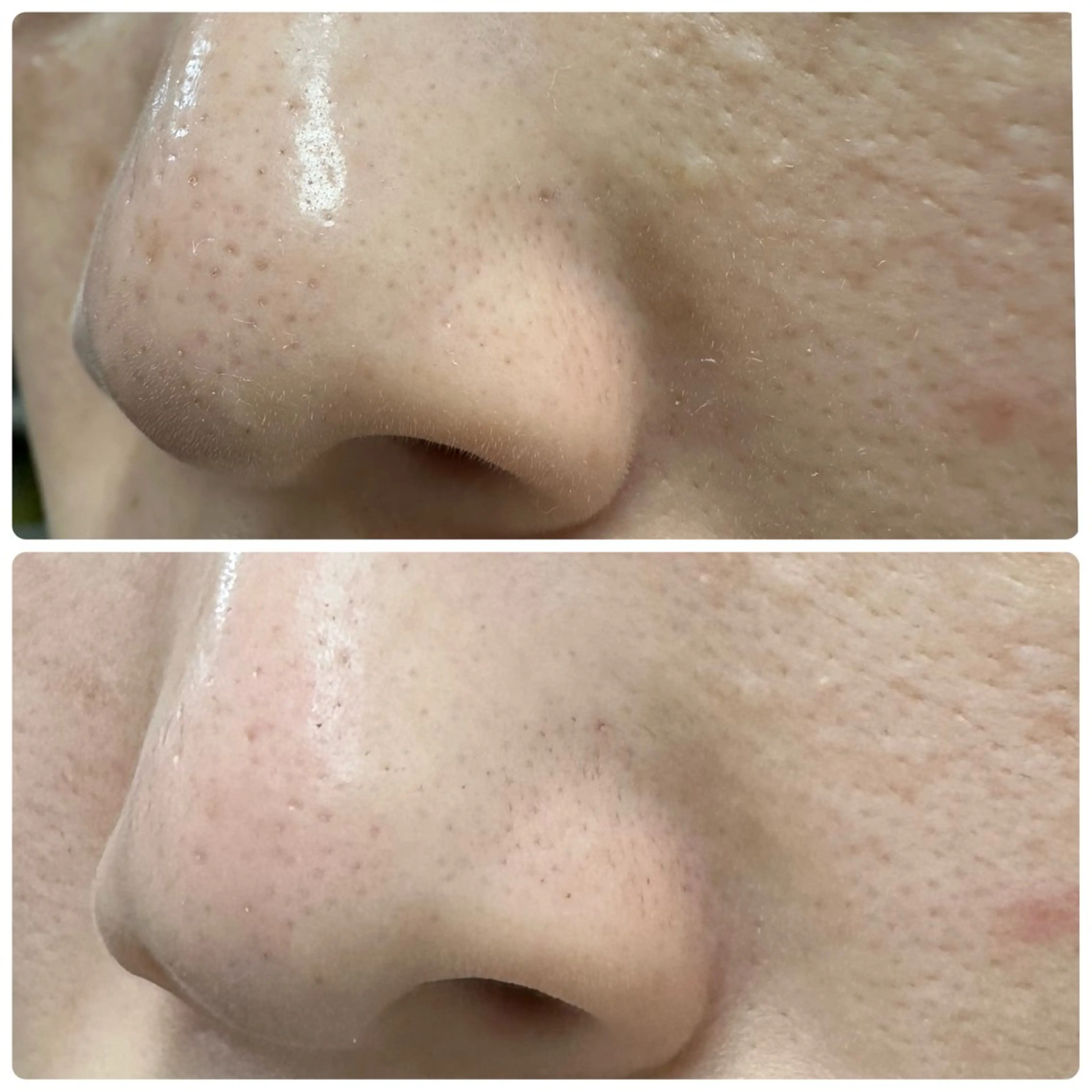 M.riche エムリシェのエステ・リラクイメージ