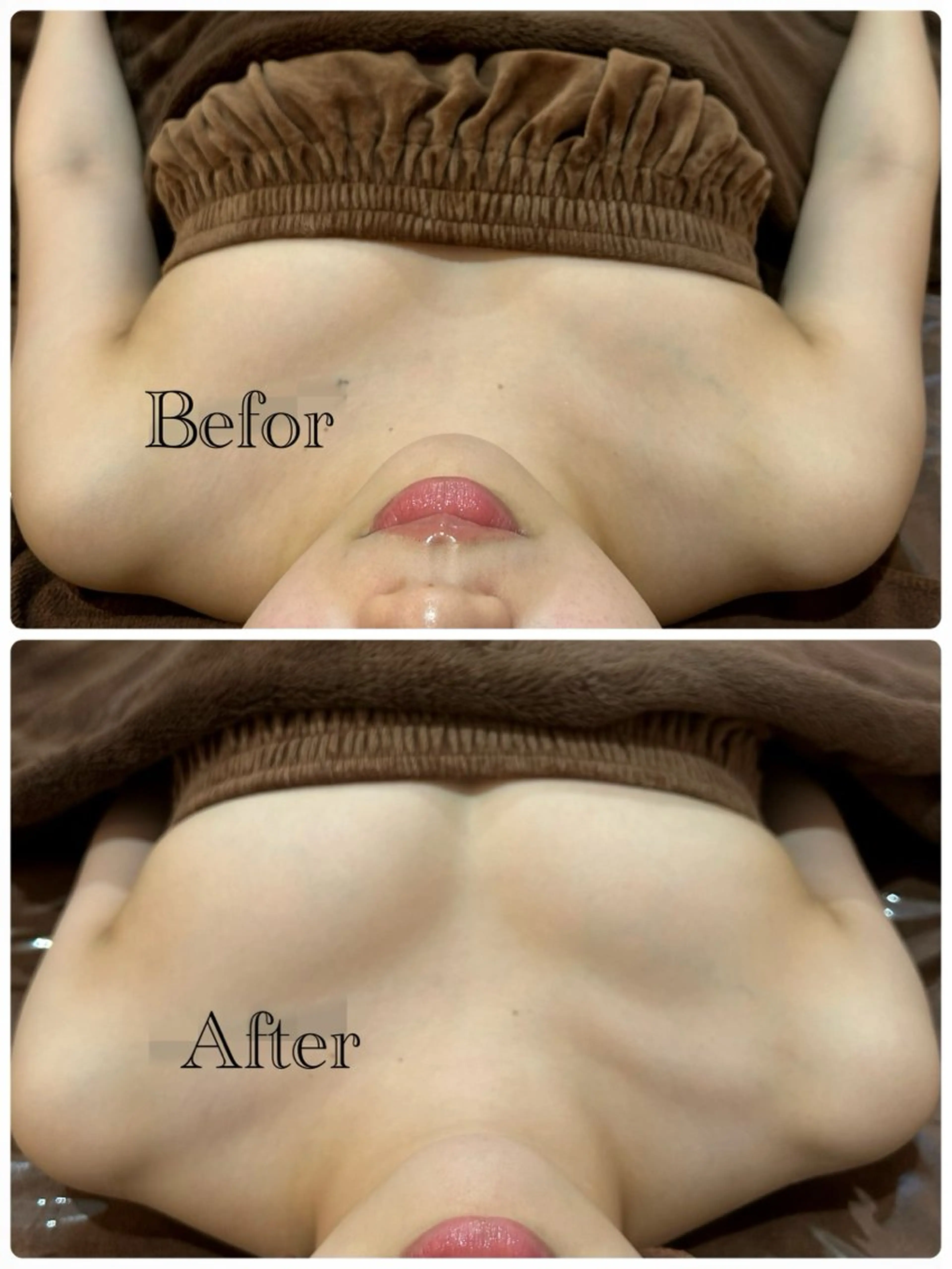 【バスト】Nine式プリンセス∞バストUP+筋膜リリース+バストクリ-ム¥14800の写真