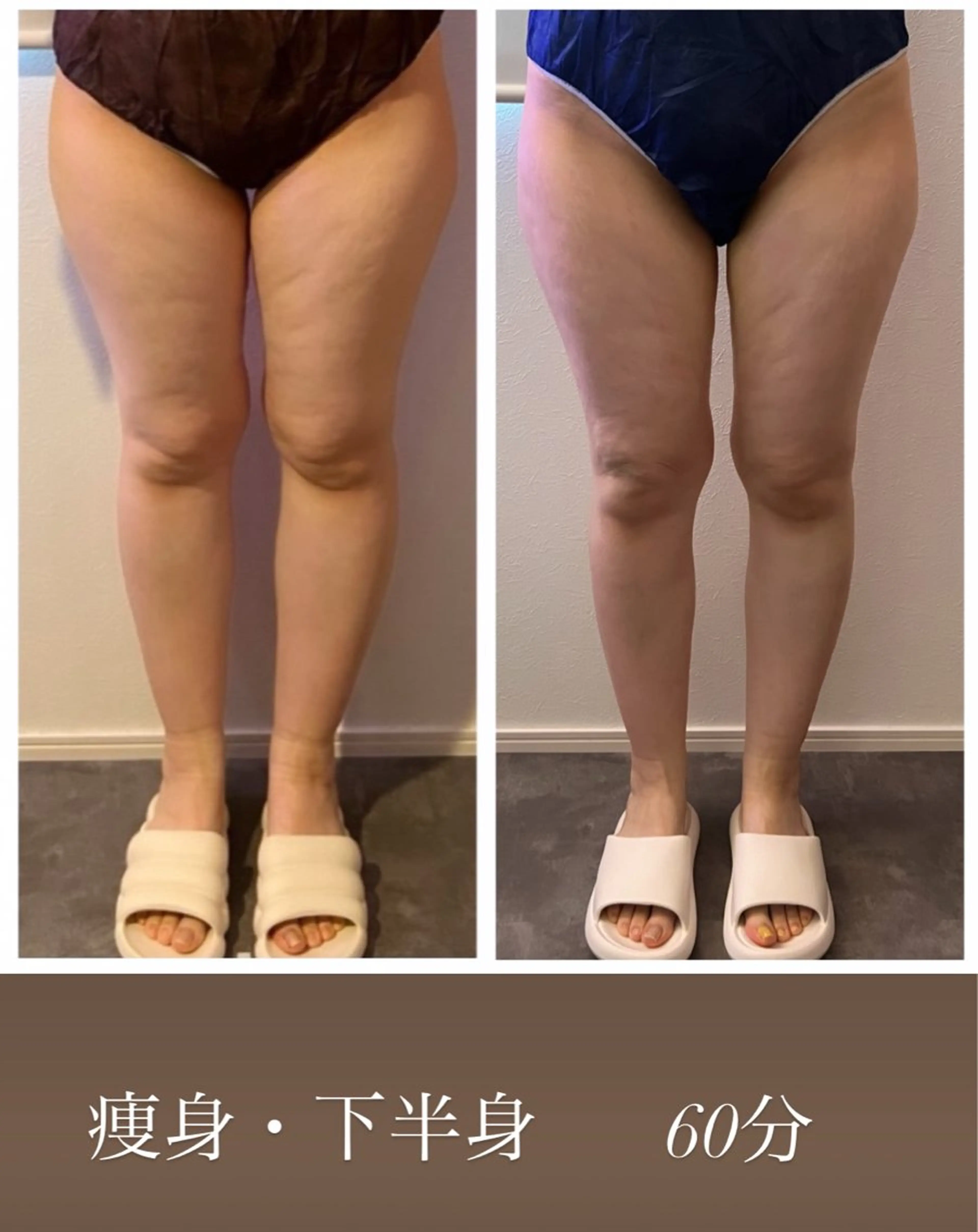 本気で痩せたい方へ 痩身専門サロンのエステ・リラクイメージ