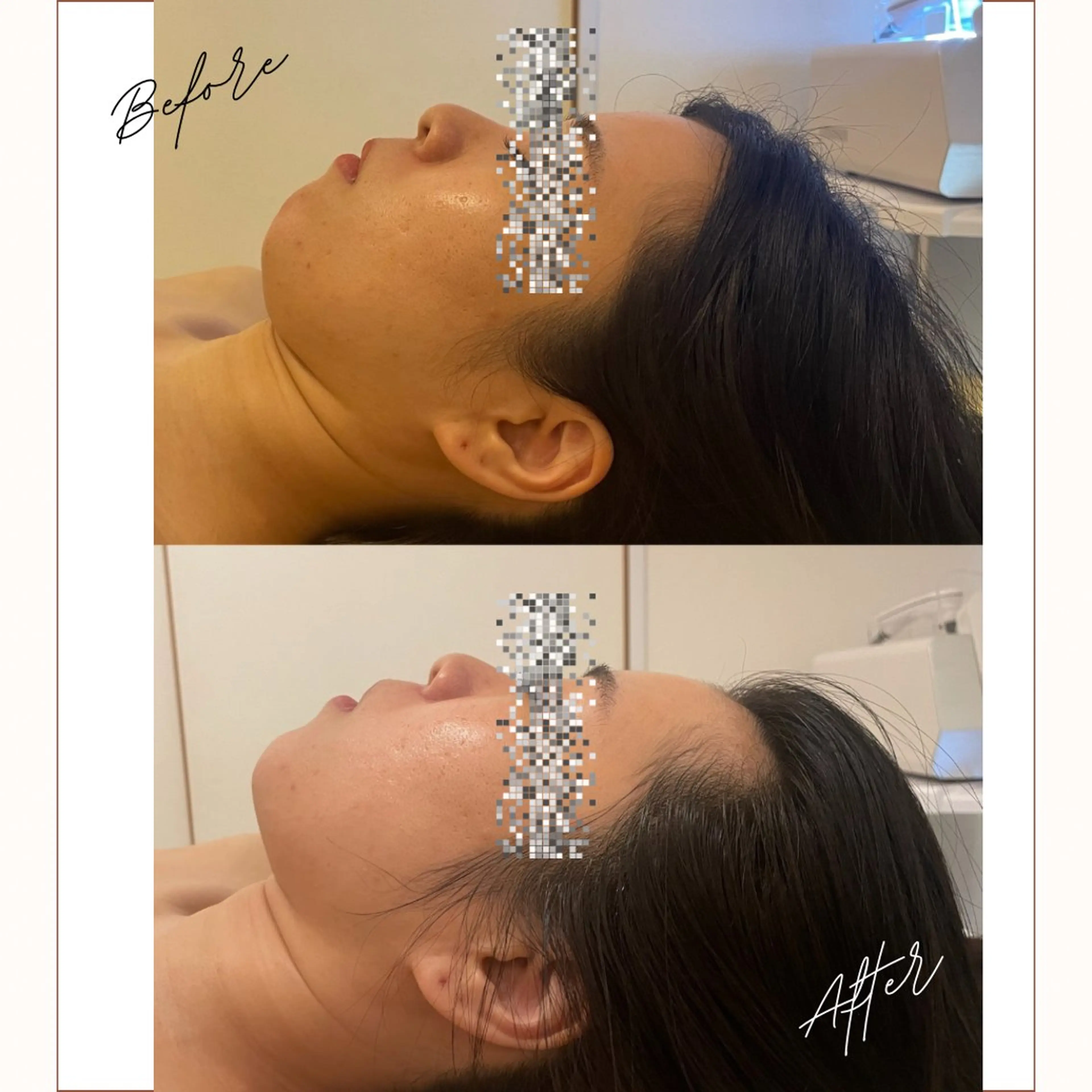 エステ 小顔/たるみ/黒ずみ除去専門サロン/SONA 大和西大寺店所属・【小顔専門看護師 サロンSONA】のエステ・リラクイメージ