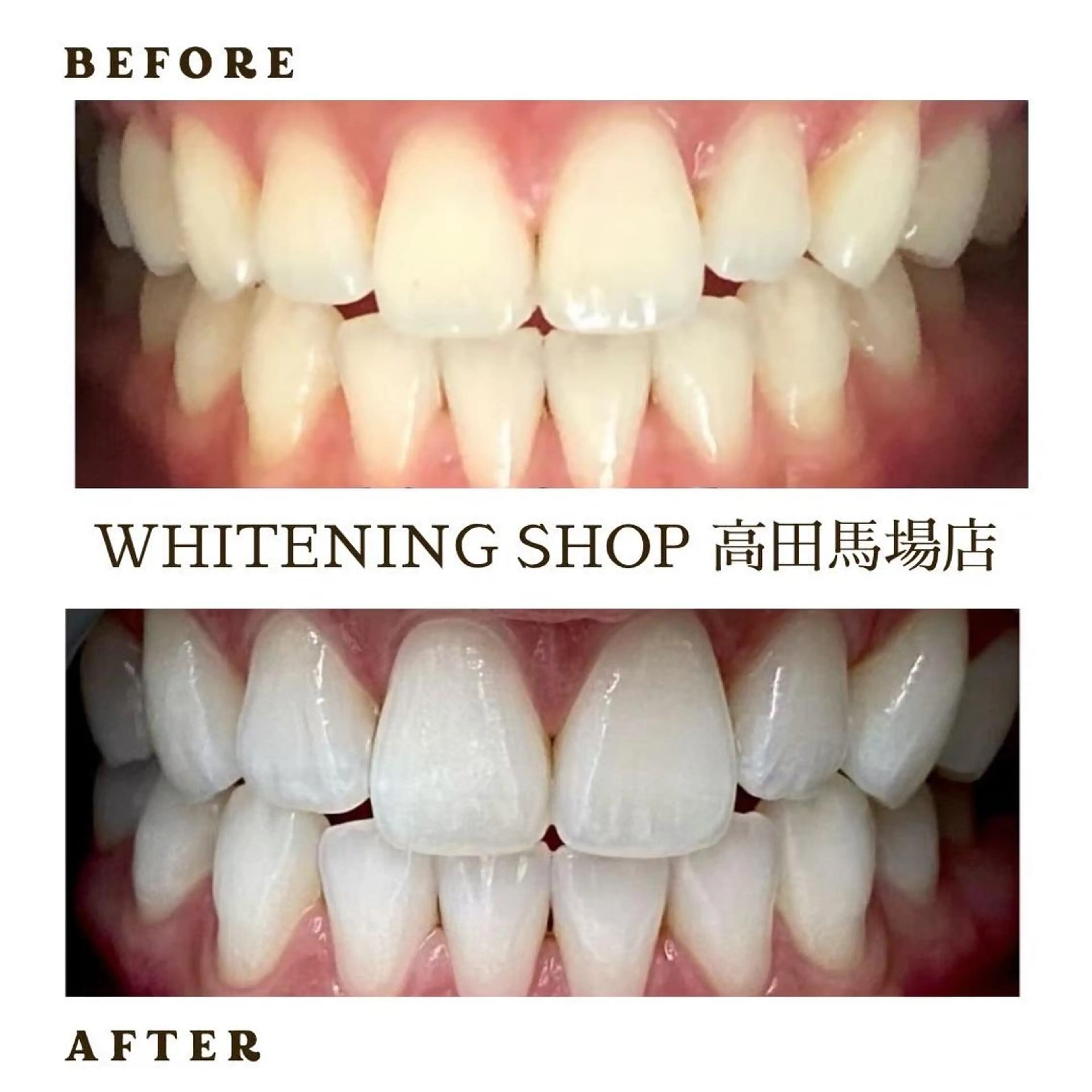 メンズ その他 ホワイトニング ショップ高田馬場店のその他イメージ