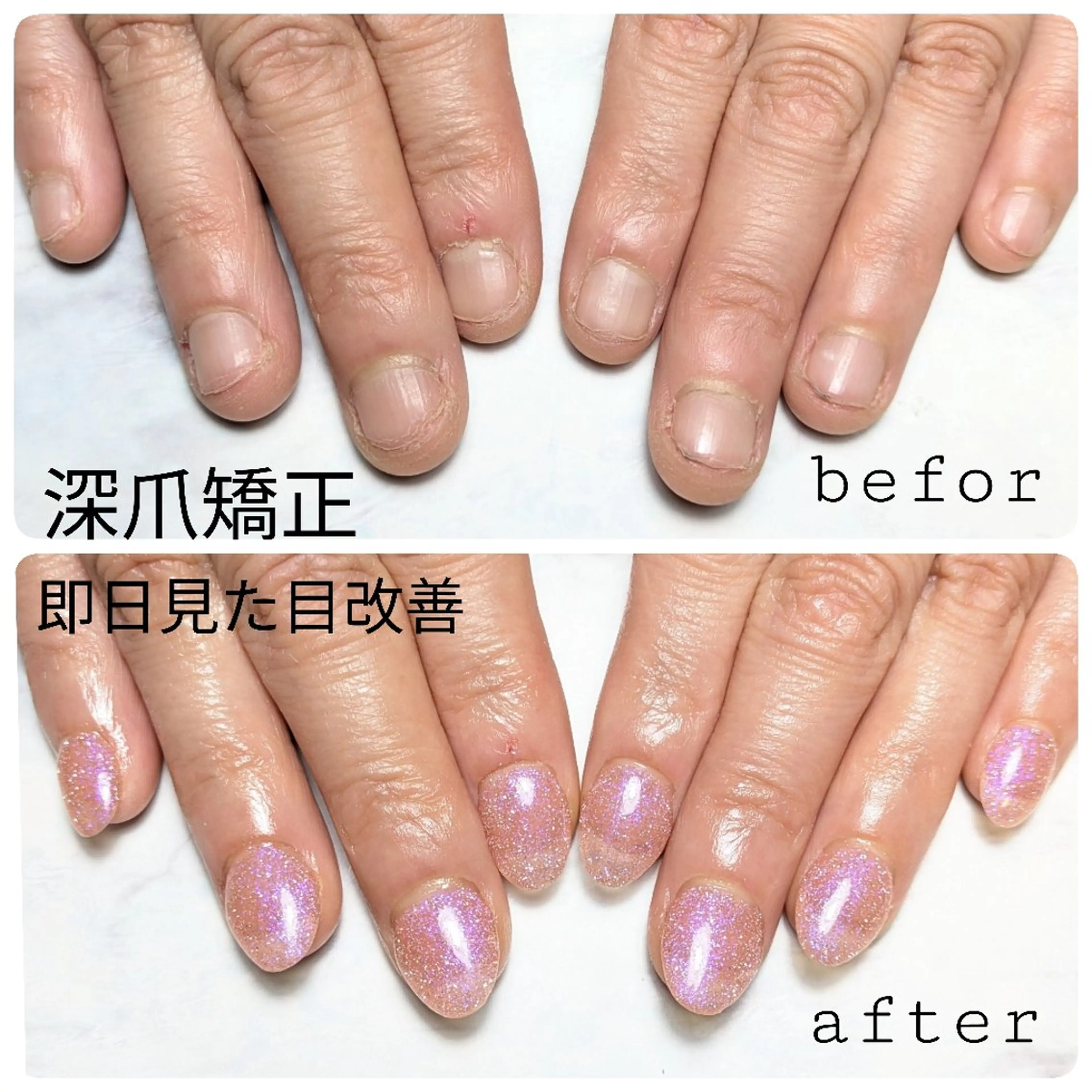 深爪矯正（ジェルオフorスカルプオフあり）スカルプ+ワンカラーorラメグラ+ネイルケア+ネイルオイルプレゼントの写真