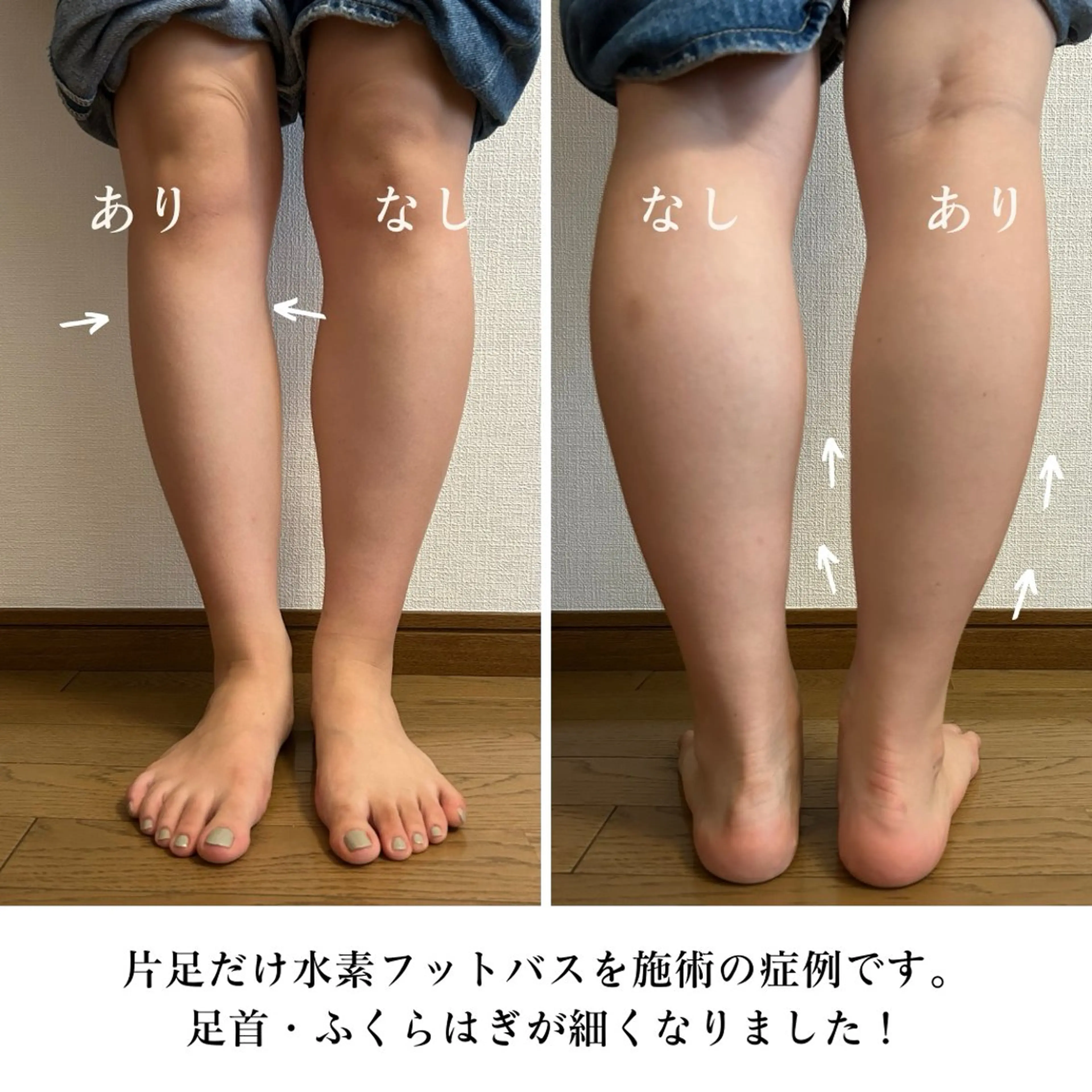 【目黒】本格痩身✴︎ 最新型よもぎ蒸しのエステ・リラクイメージ