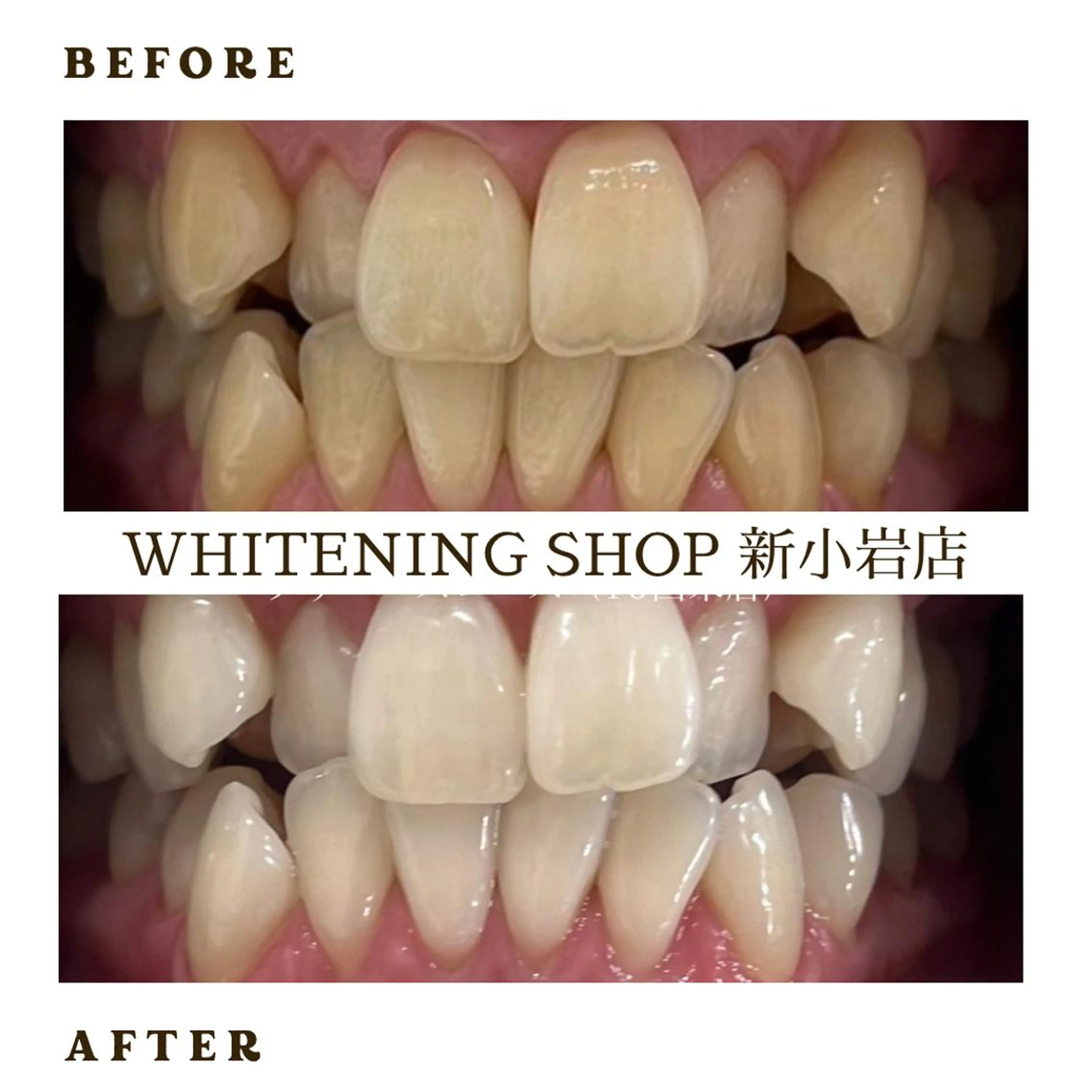 メンズ ホワイトニング ショップ新小岩店のその他イメージ