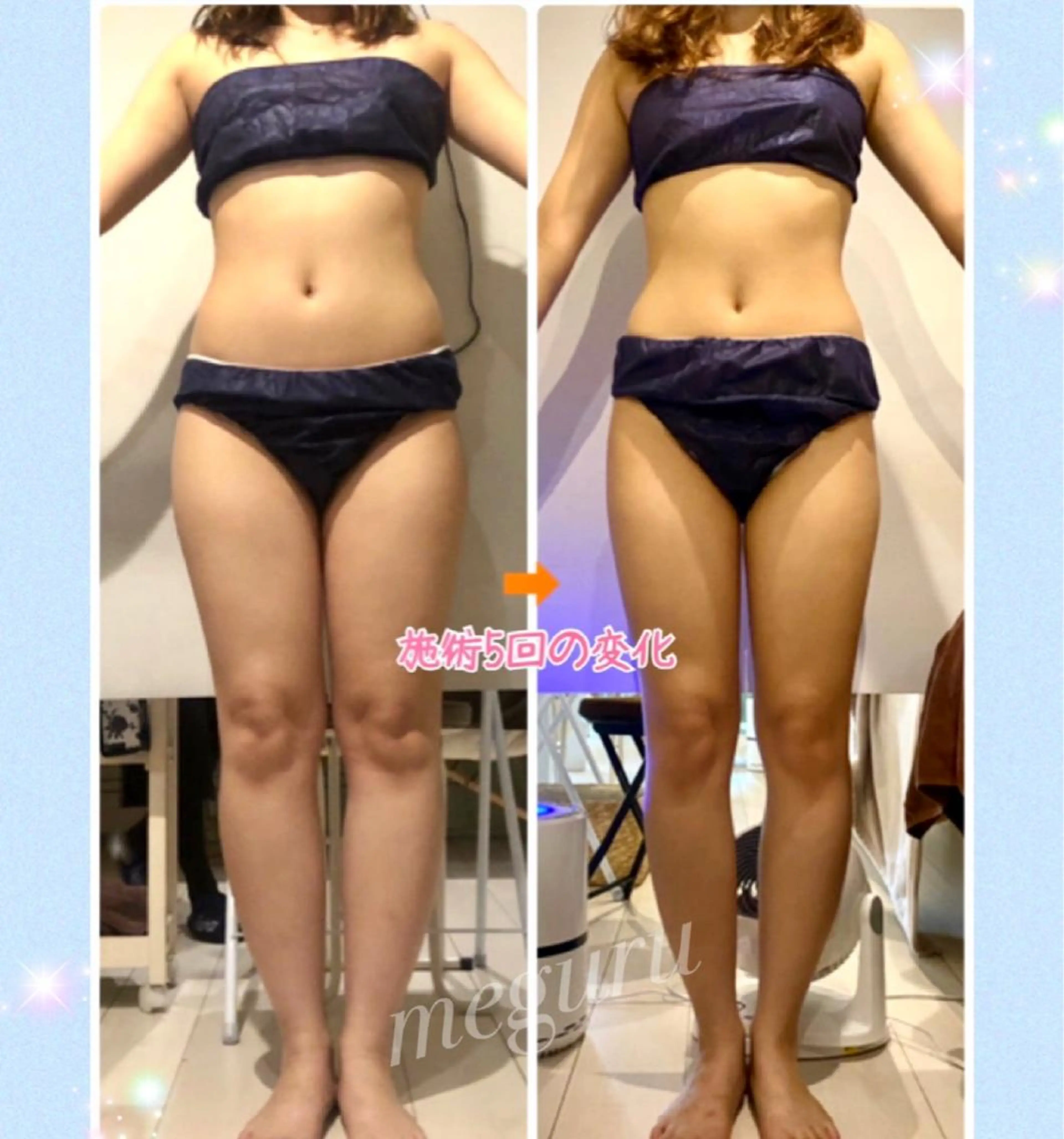 ショート カラー パーマ ヘアアレンジ メンズ キッズ ネイル マツエク・マツパ エステ リラク ‍痩身＆ボディ 結果出し🌟丹野のエステ・リラクイメージ