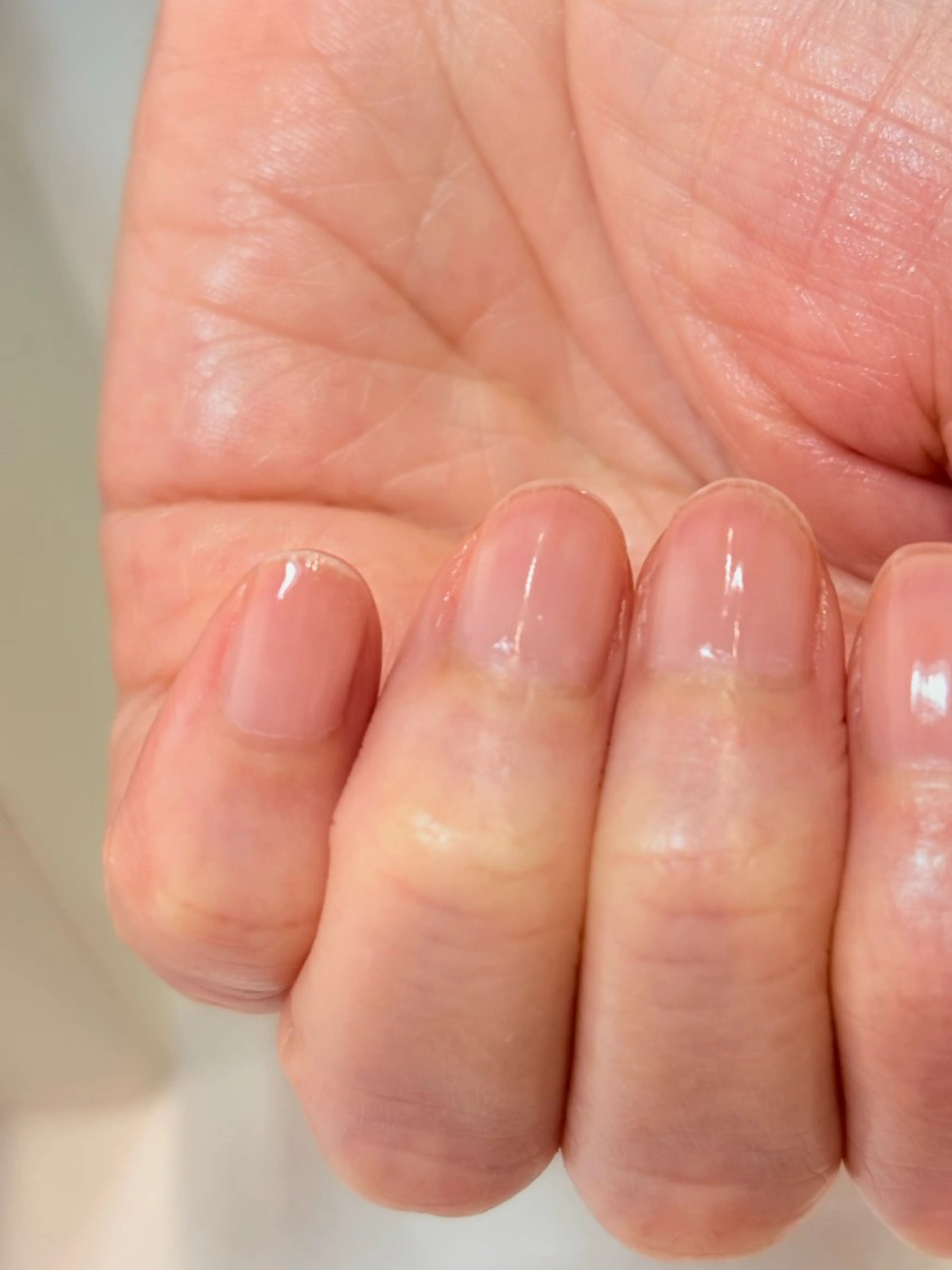 月曜日限定スペシャルネイルケアの写真