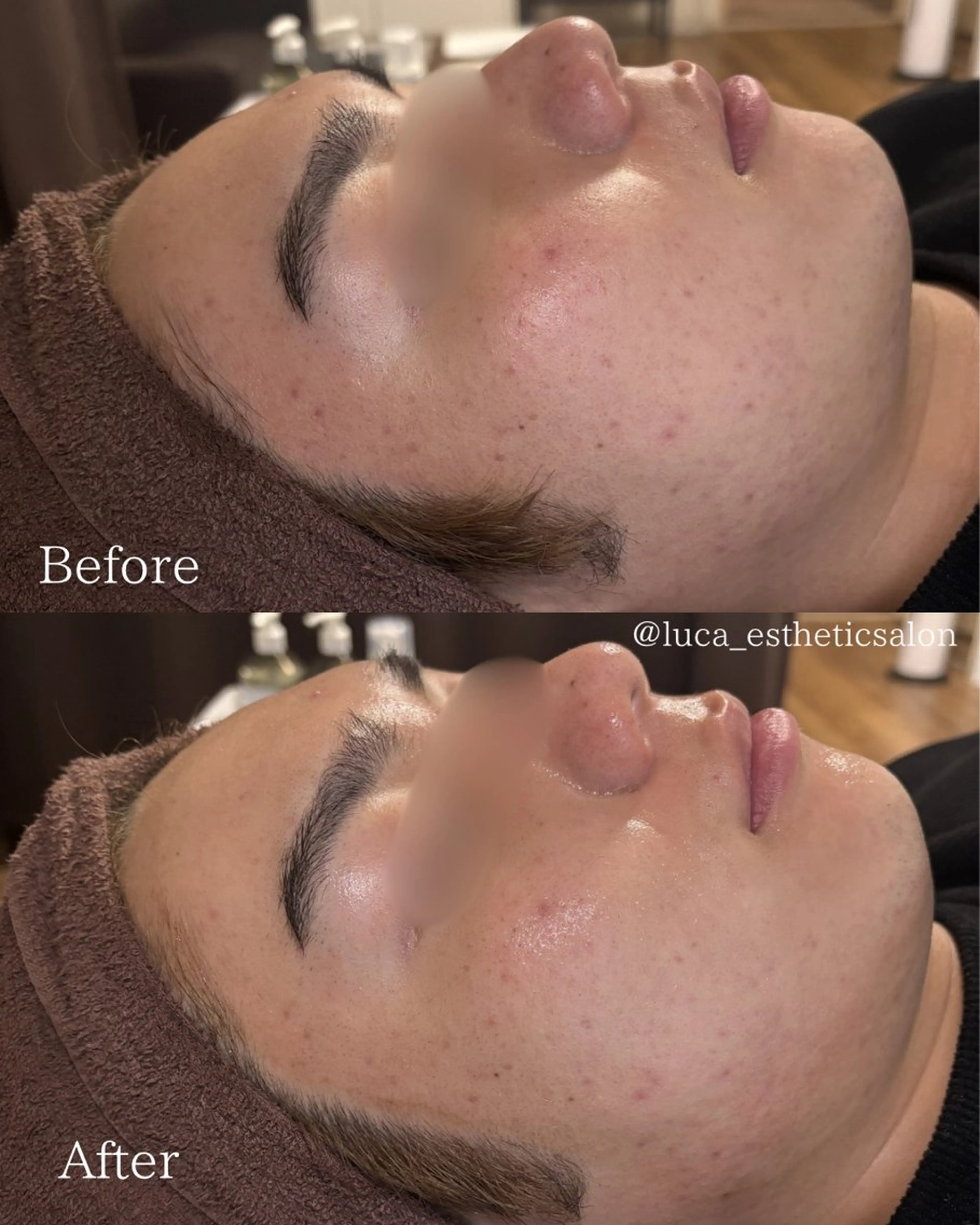 エステ Luca所属・Luca ﾙｶのエステ・リラクイメージ