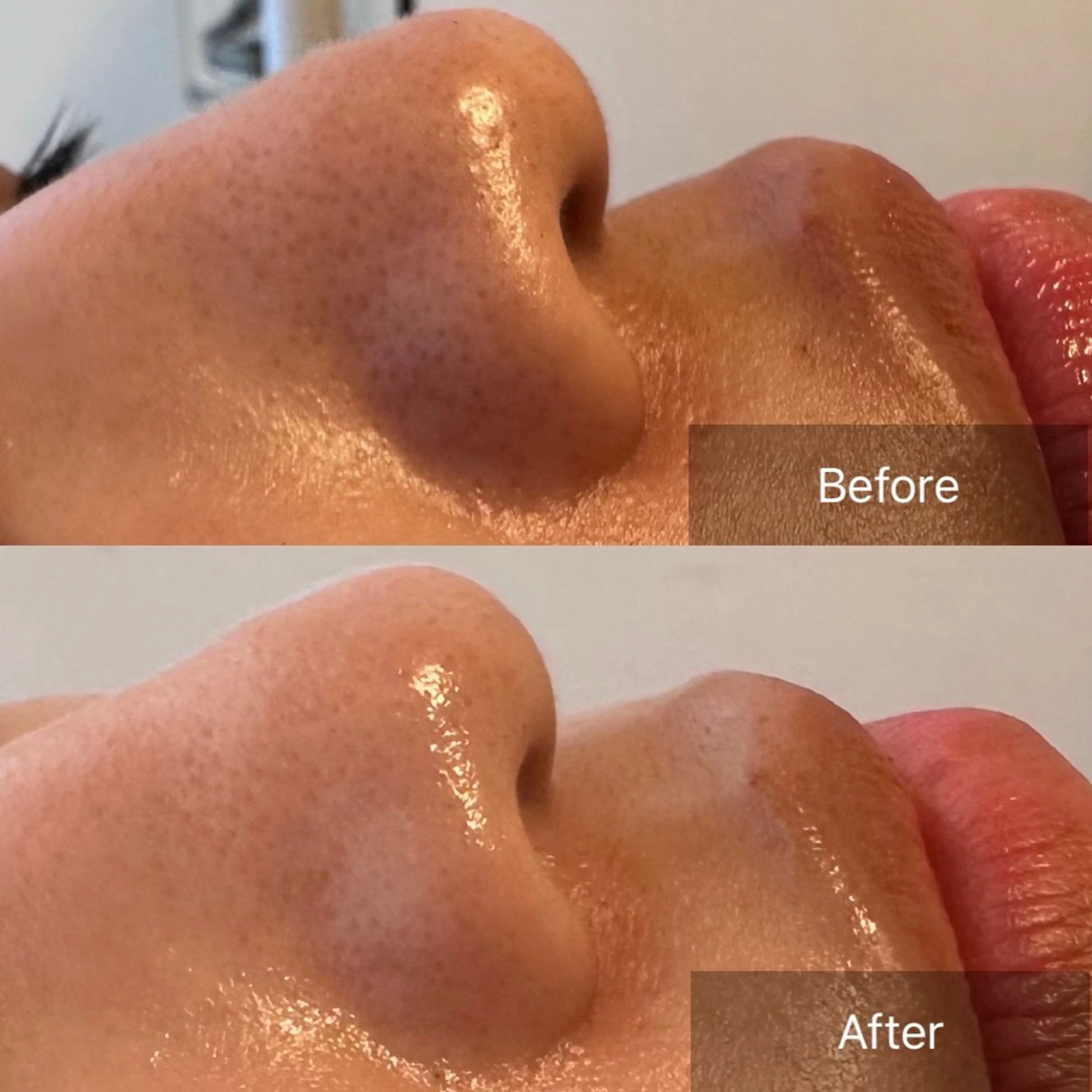 その他 肌育ピーリング 🫧megumiのエステ・リラクイメージ