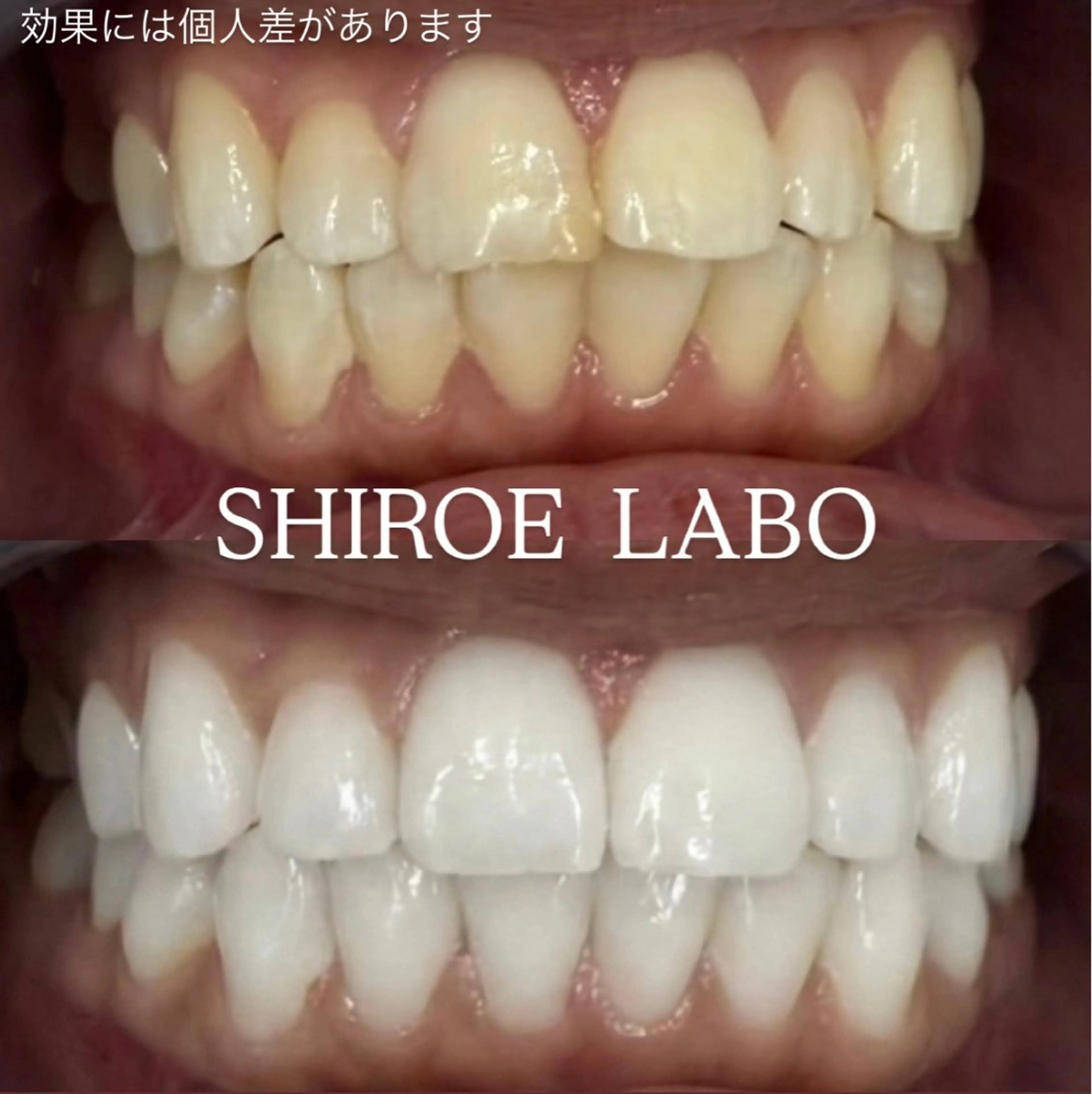 その他 【歯のホワイトニング専門店】シロエラボ梅田店所属・シロエラボ 梅田店のその他イメージ