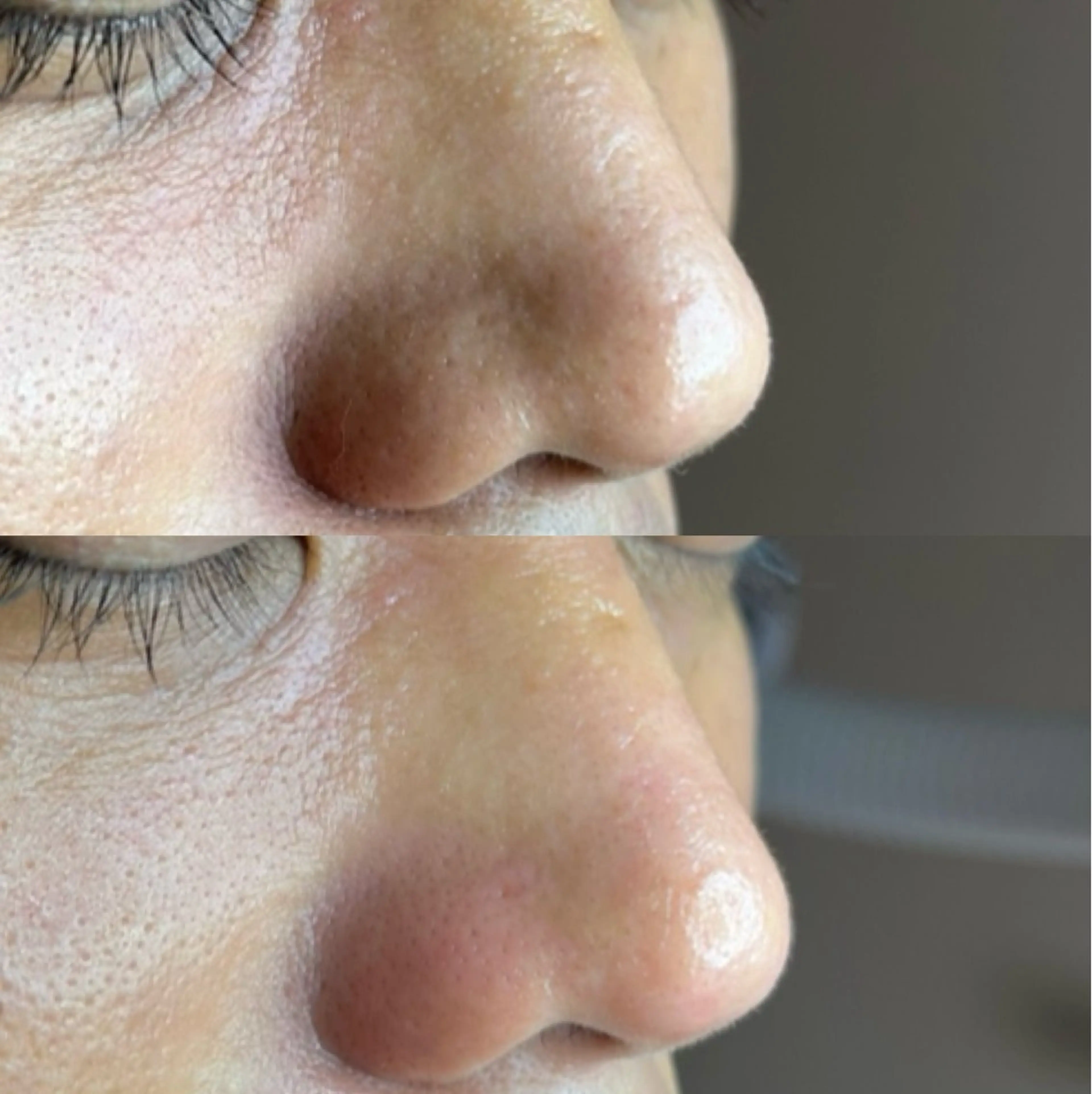 メンズ 毛穴ケア・ヘッドスパサロンSHINY(シャイニー)所属・毛穴ケア・ヘッドスパ サロンSHINYのエステ・リラクイメージ