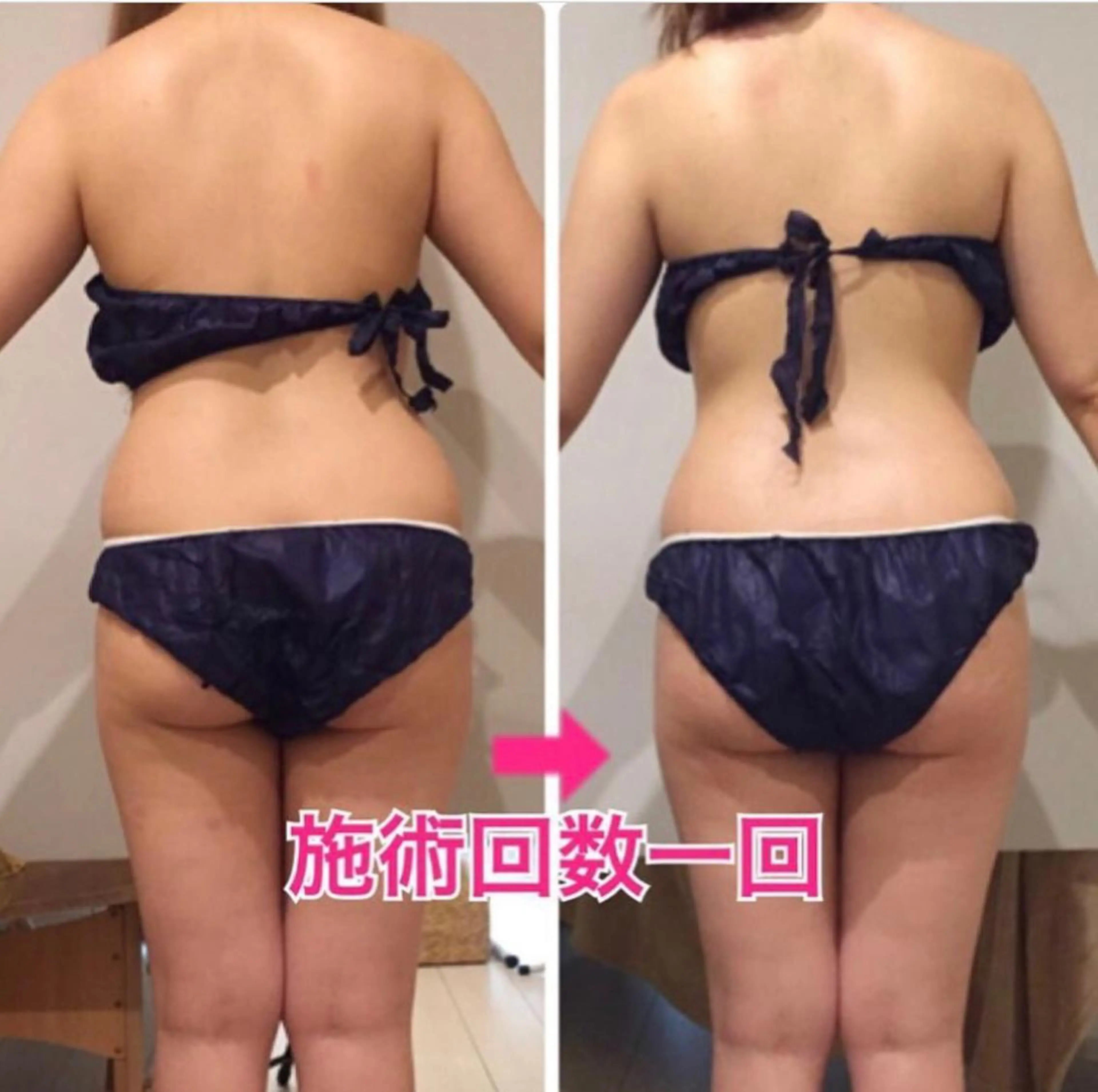 ショート カラー パーマ ヘアアレンジ メンズ キッズ ネイル マツエク・マツパ ‍痩身＆ボディ 結果出し🌟丹野のエステ・リラクイメージ