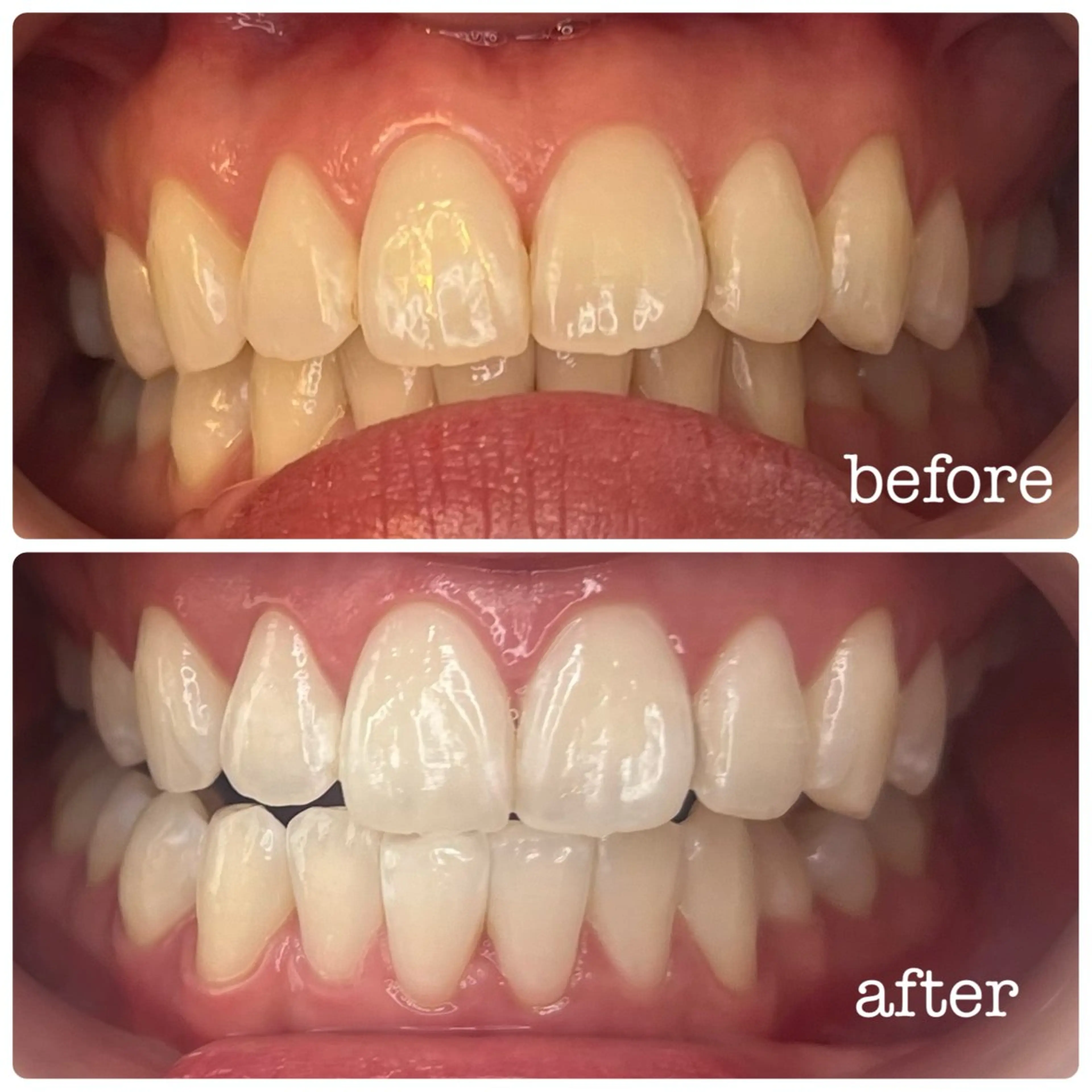 DH. MISATOの眉毛・アイブロウイメージ