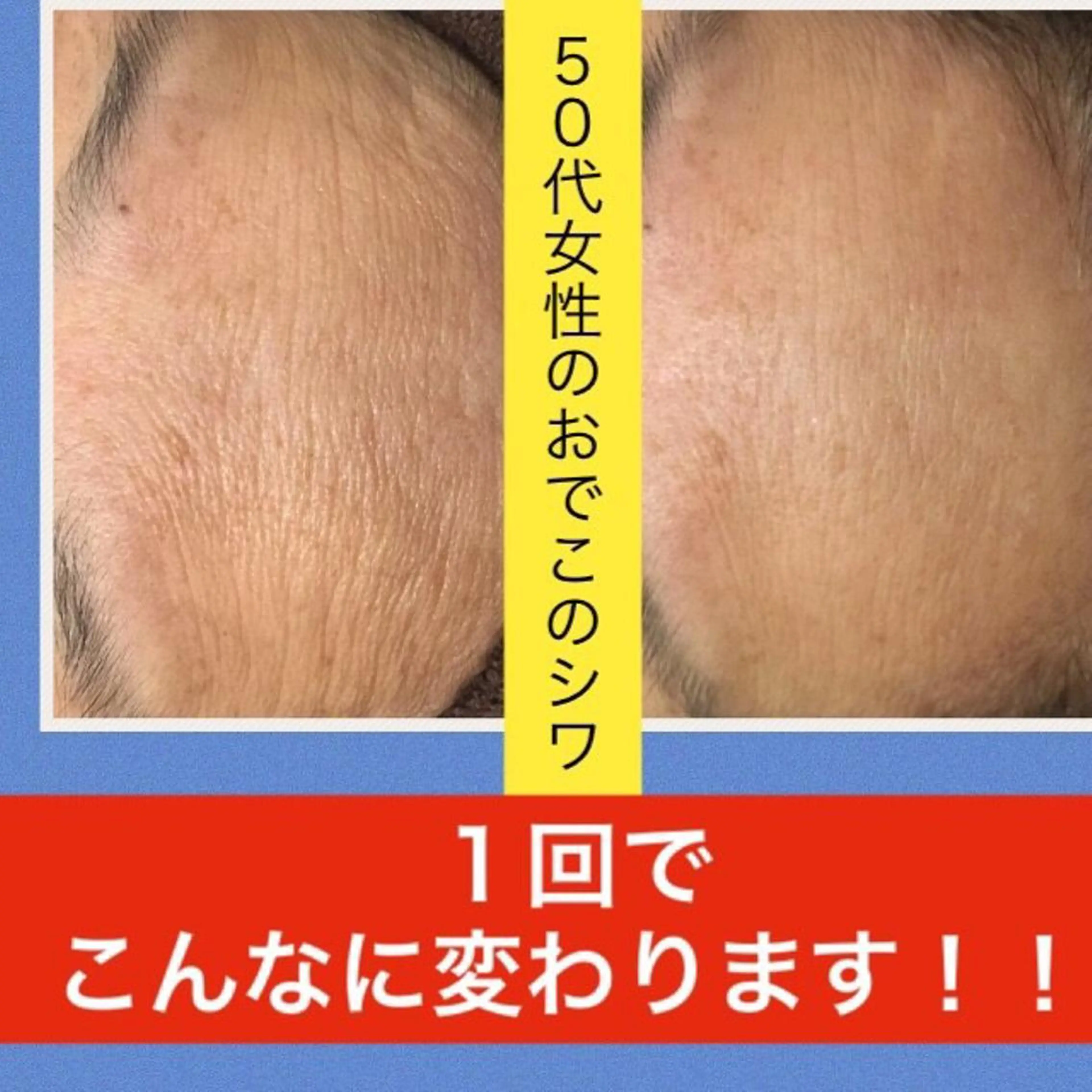 ロング カラー パーマ ヘアアレンジ メンズ キッズ ネイル マツエク・マツパ ニキビ・肌質改善専門 ♡人生が変わるサロンのエステ・リラクイメージ