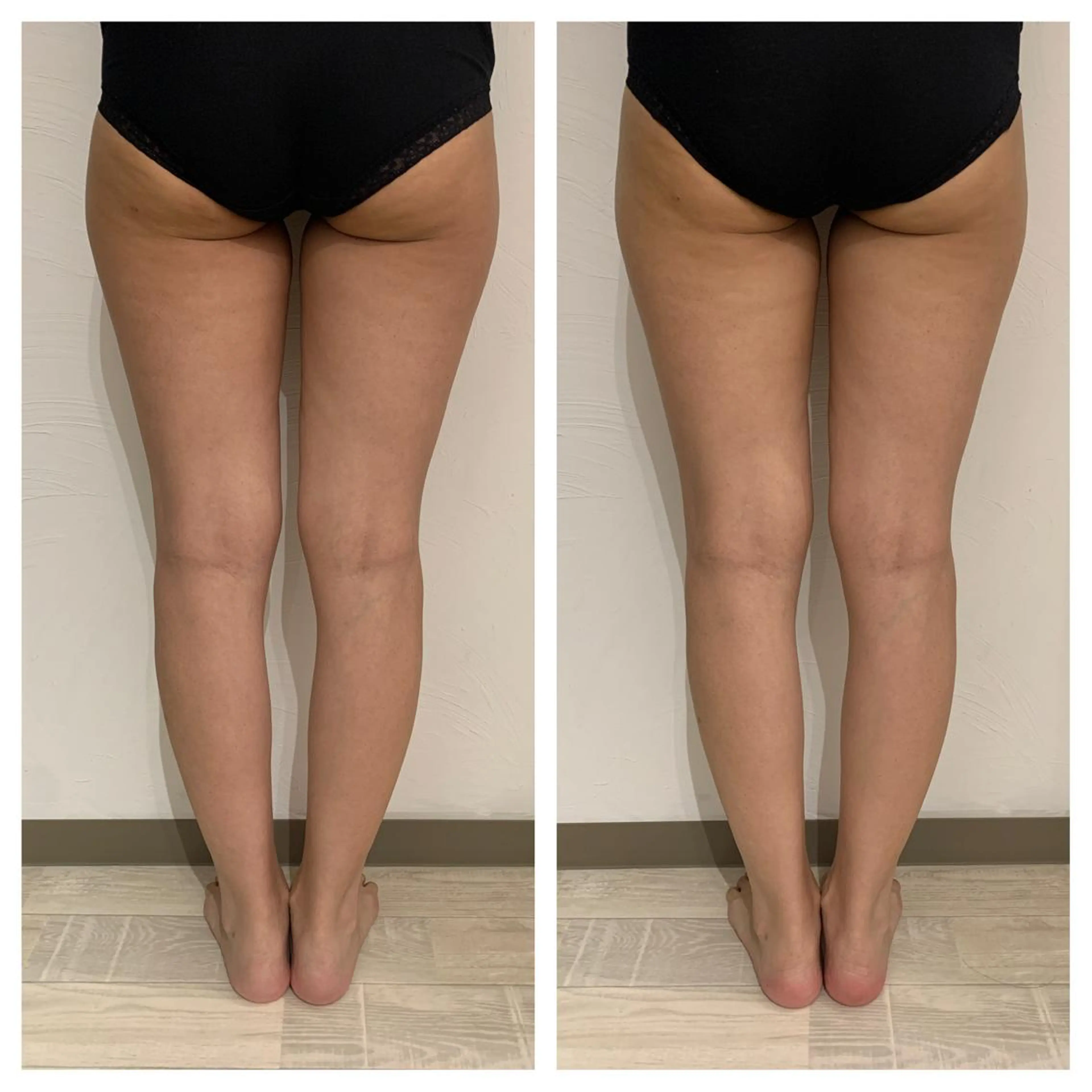 リンパマッサージ&ピラティスmimoza所属・リンパマッサージ mimozaのエステ・リラクイメージ