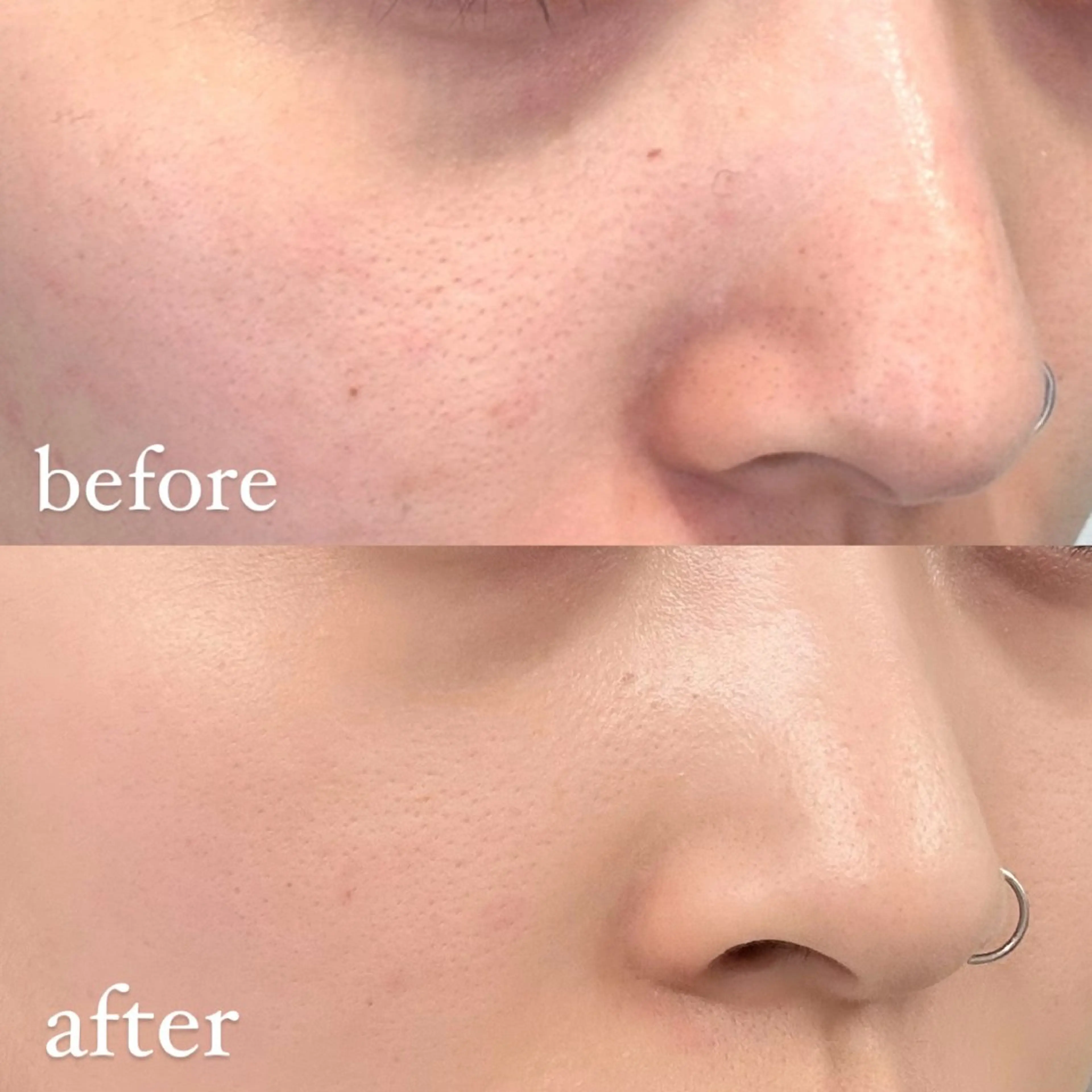 エステ 🦋美肌サロン. maho🦋のエステ・リラクイメージ