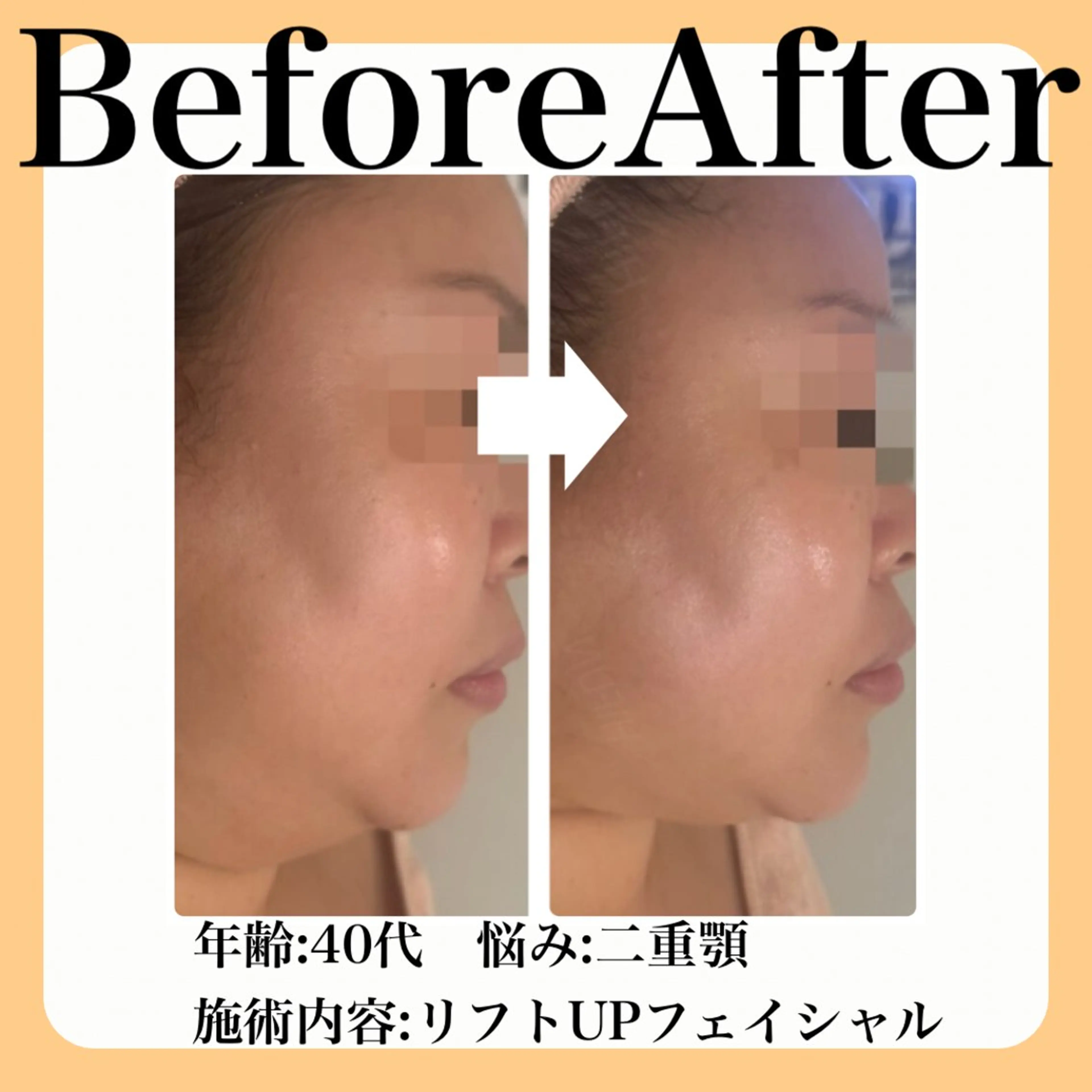 エステ 毛穴・たるみ･ニキビケア専門サロンsui所属・sui【スイ】 ARISAのエステ・リラクイメージ